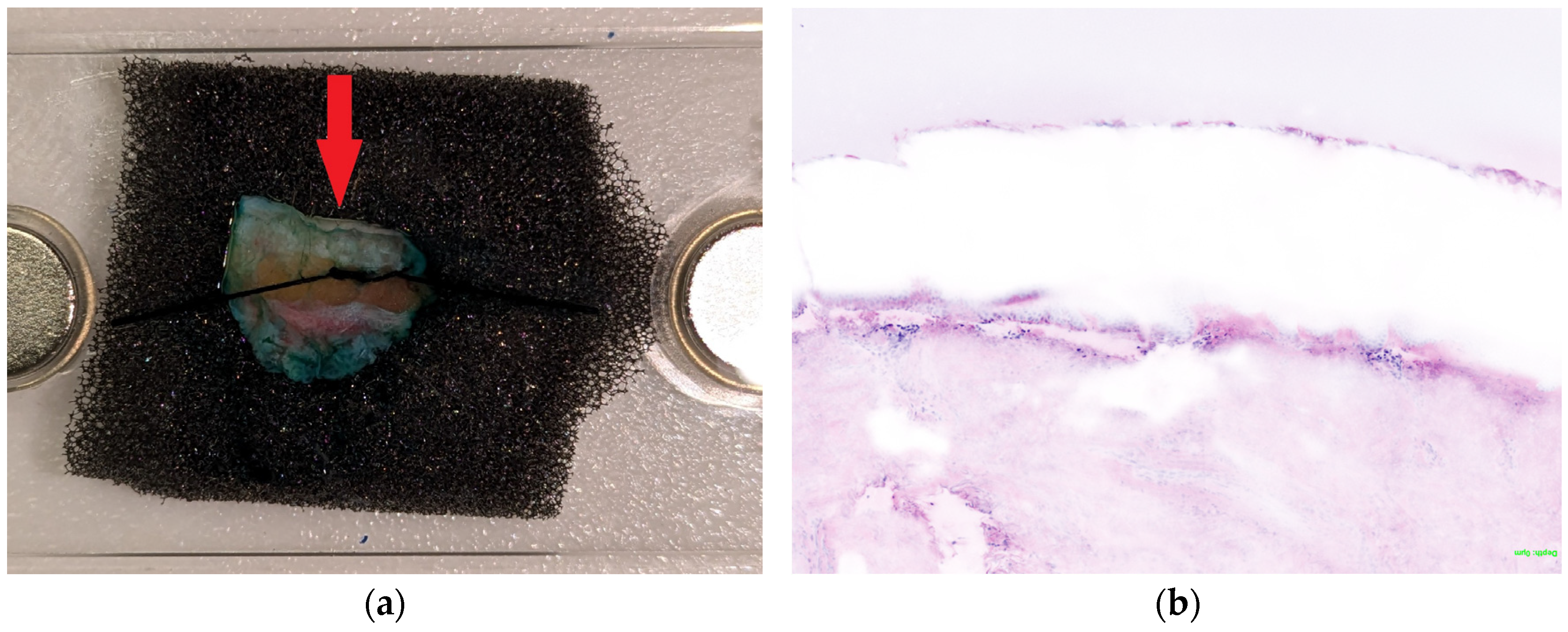 Cancers 16 03209 g003