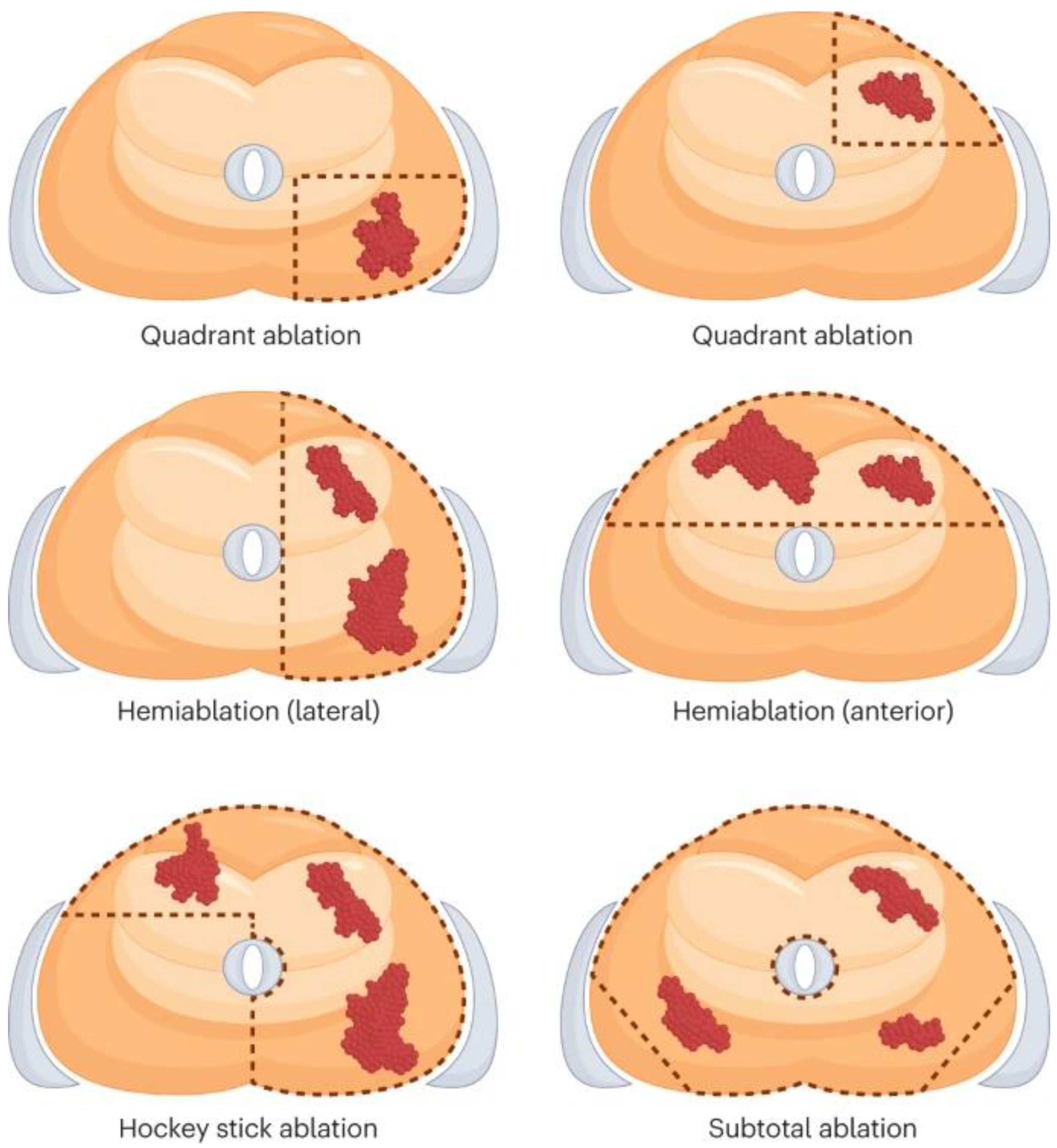 Cancers 16 03225 g001 Cancers 16 03225 g001