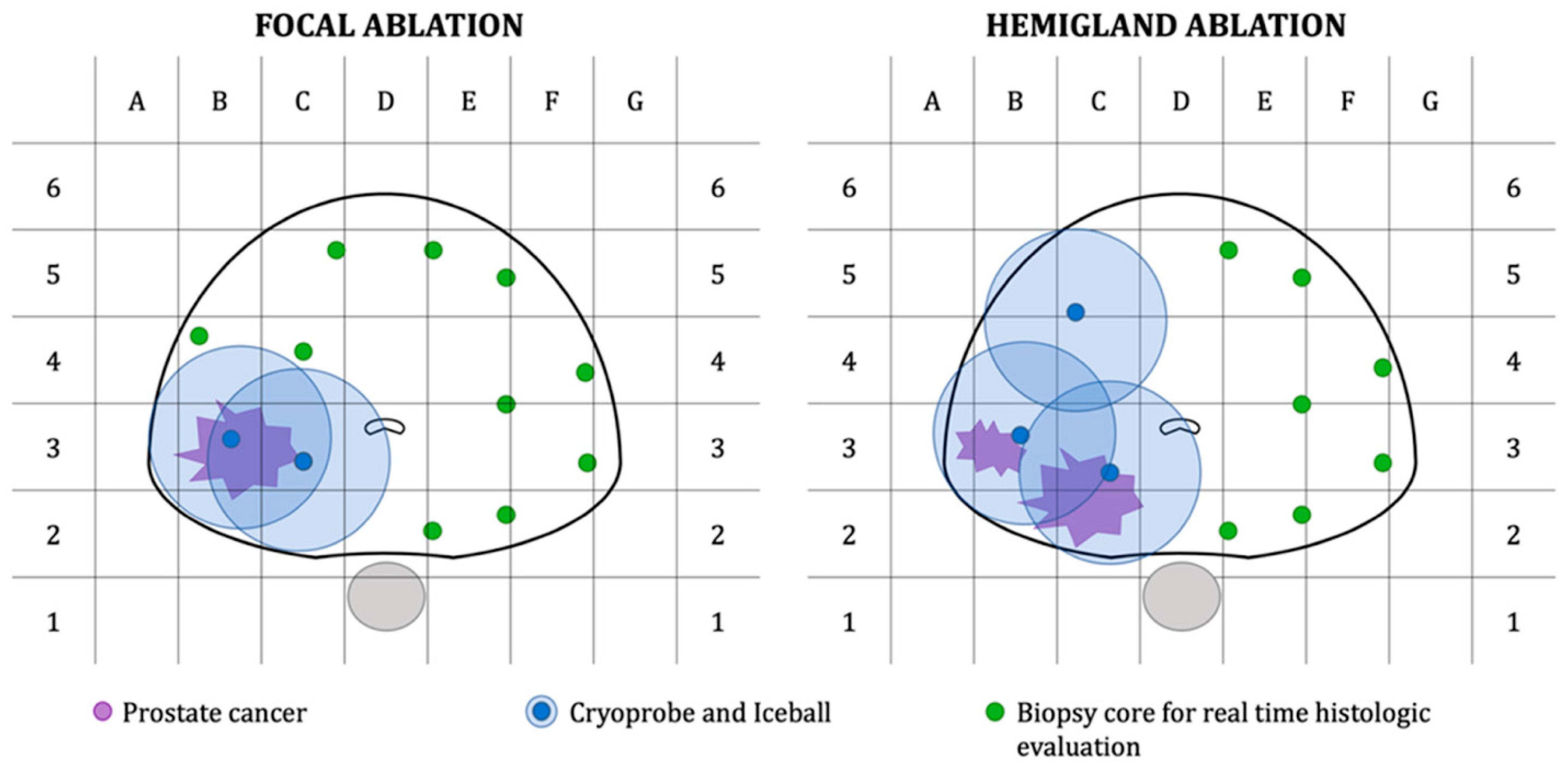 Cancers 16 03225 g002 Cancers 16 03225 g002