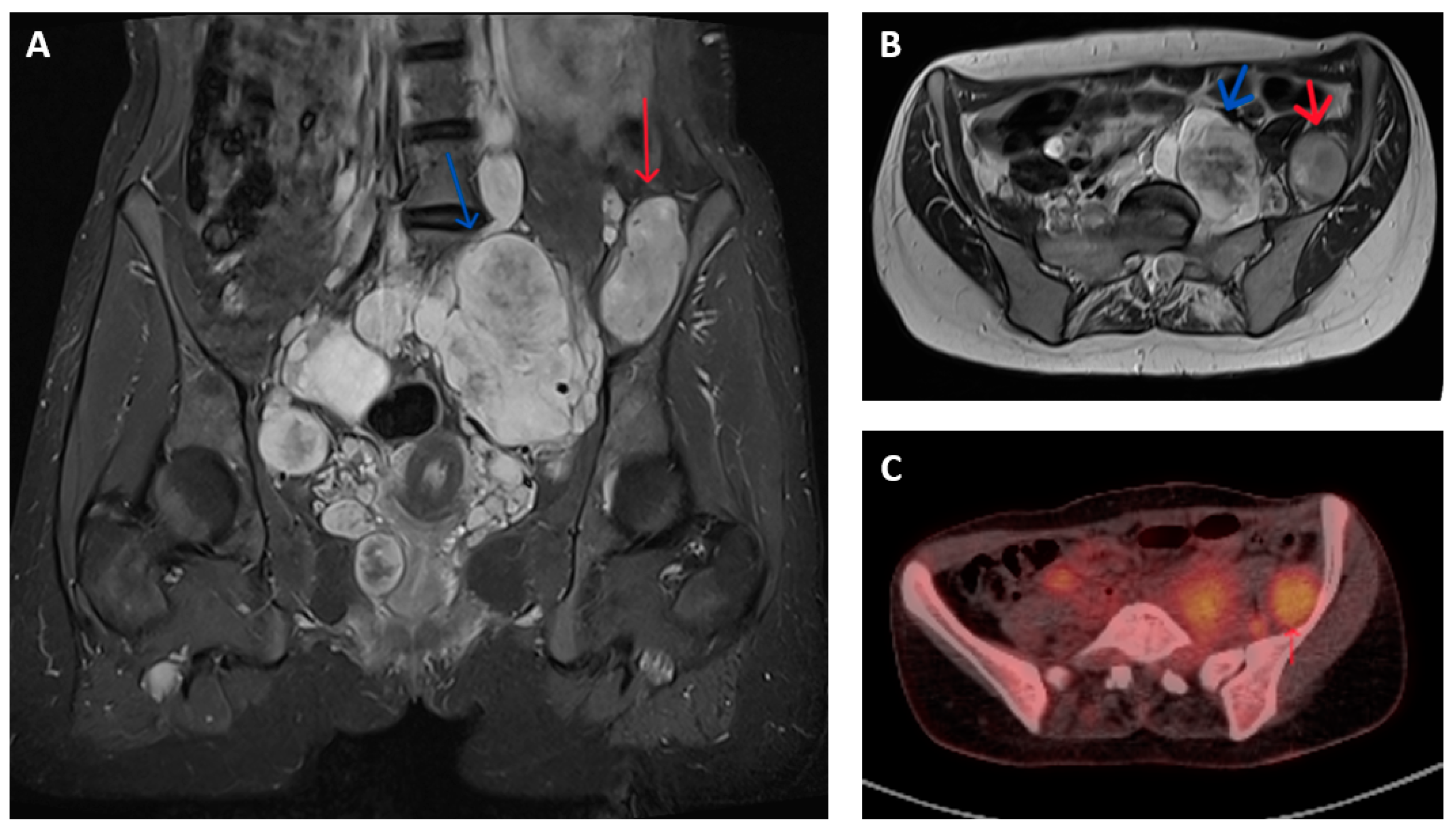 Cancers 16 03266 g001