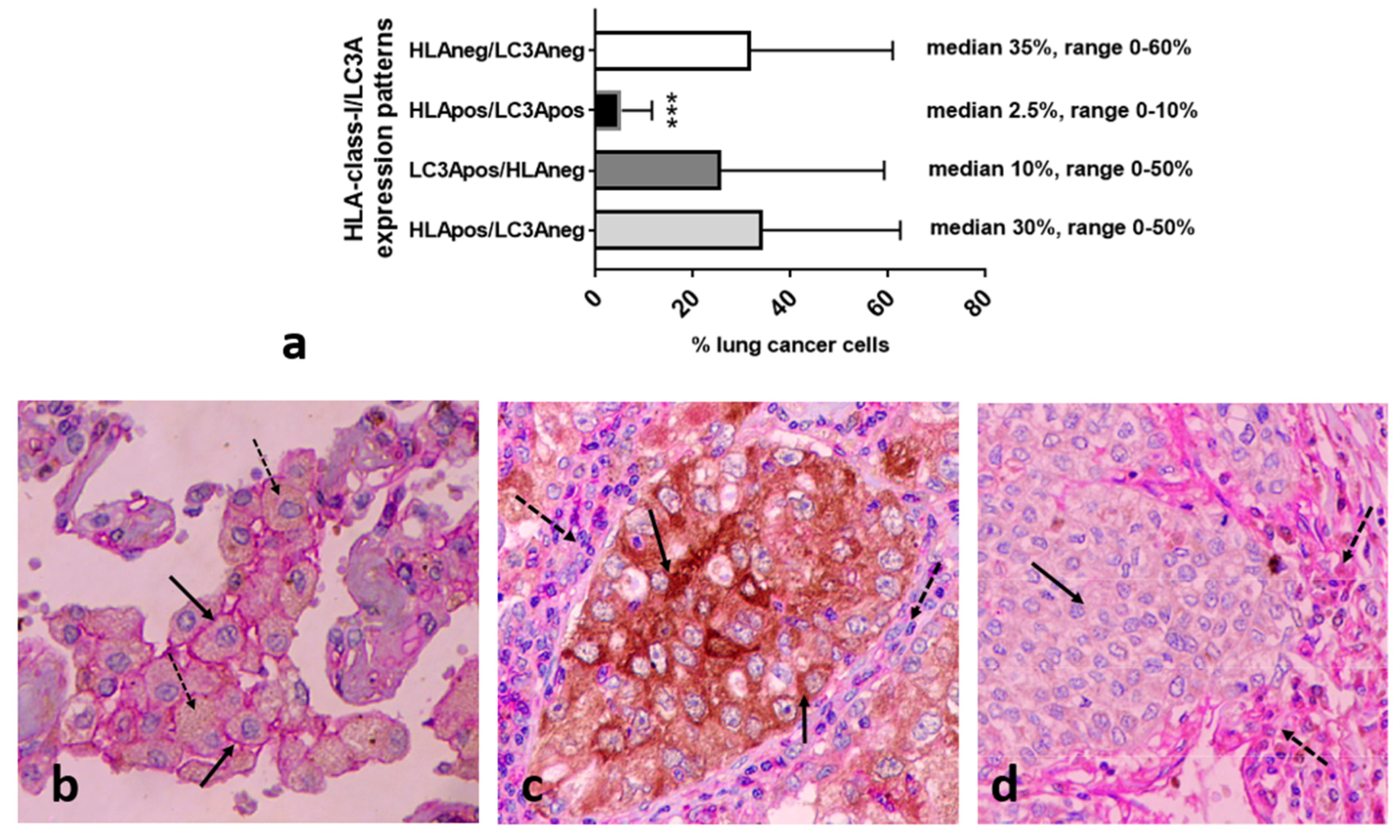 Cancers 16 03272 g004