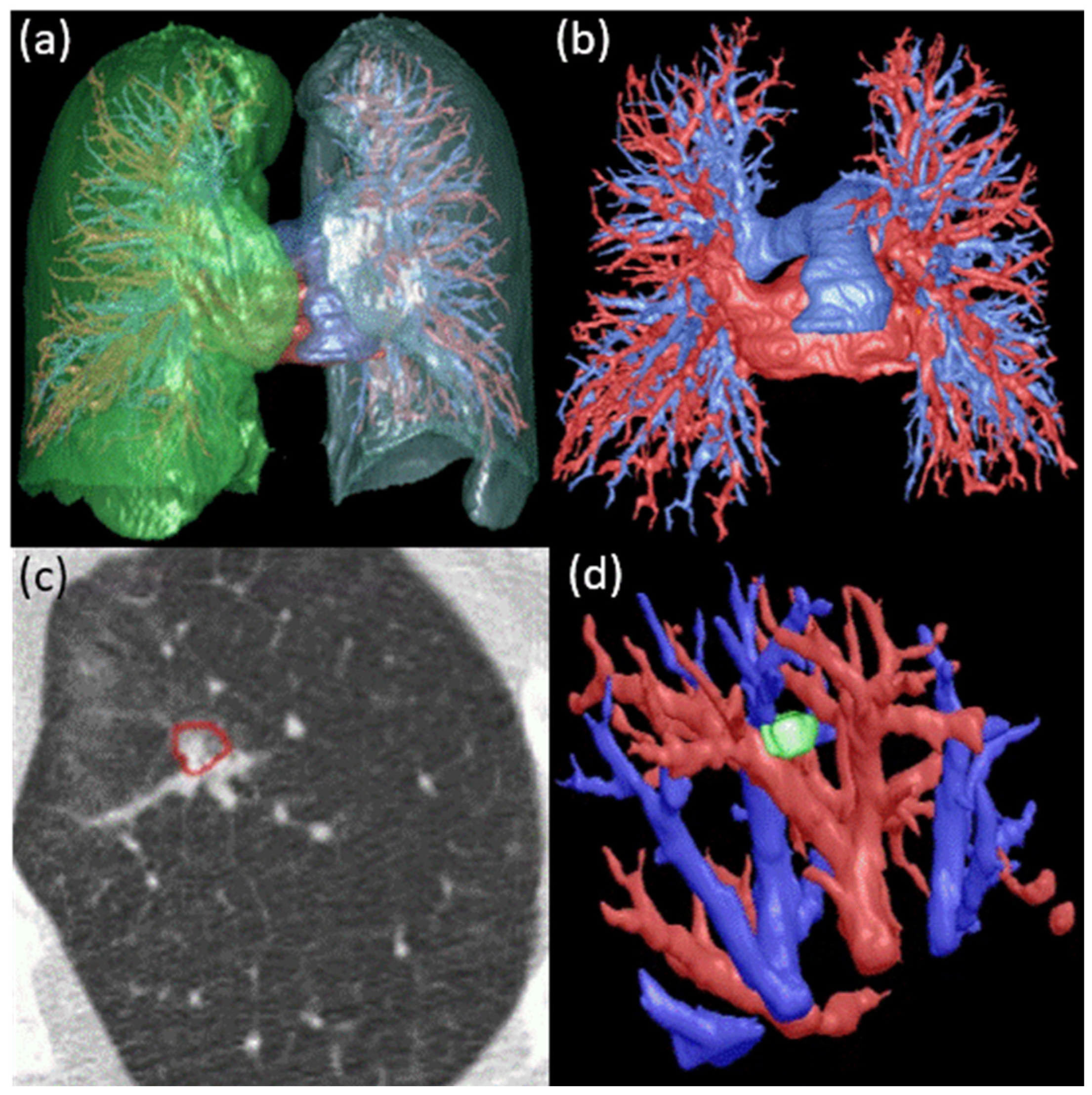 Cancers 16 03274 g001