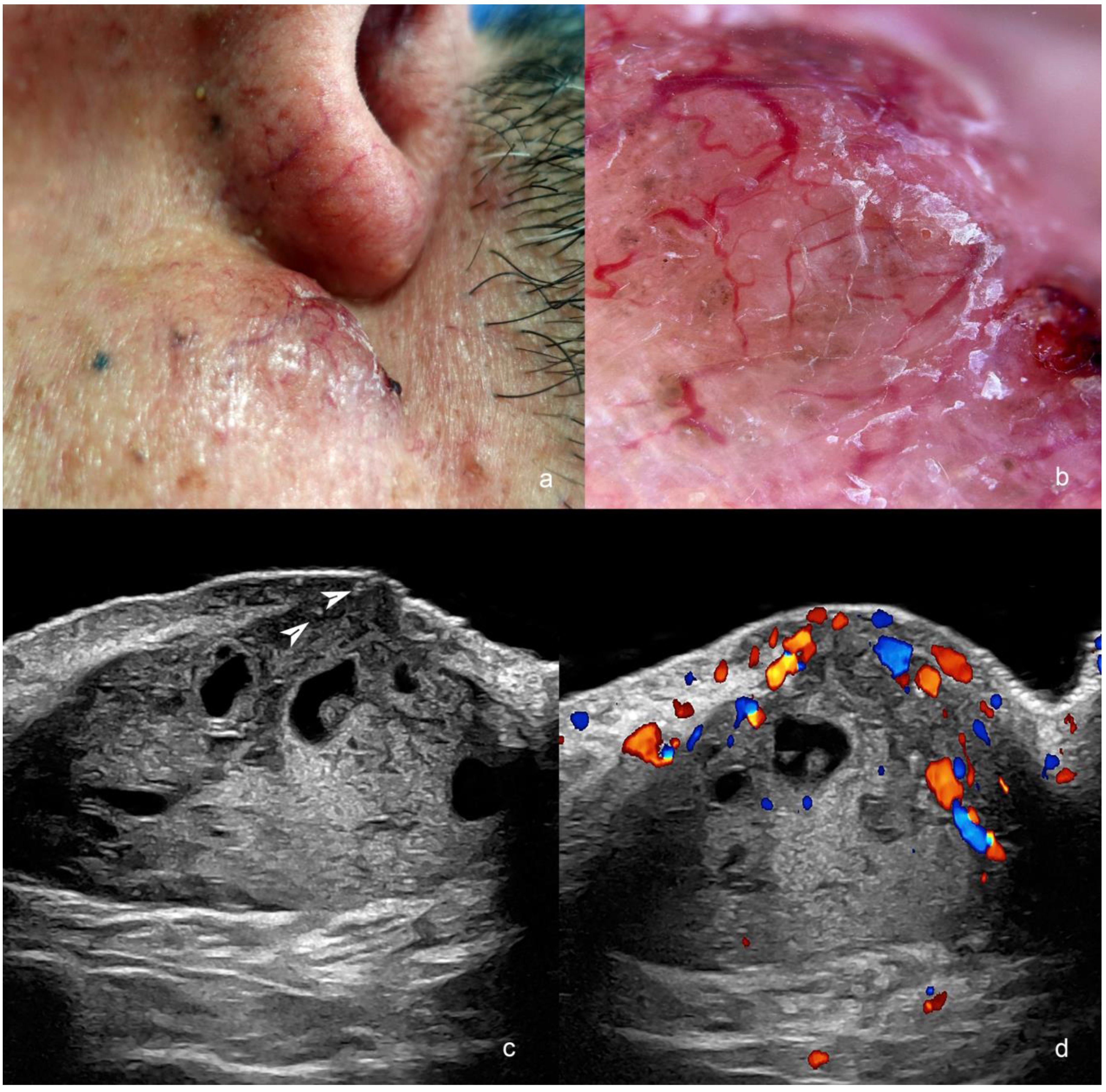 Cancers 16 03301 g002