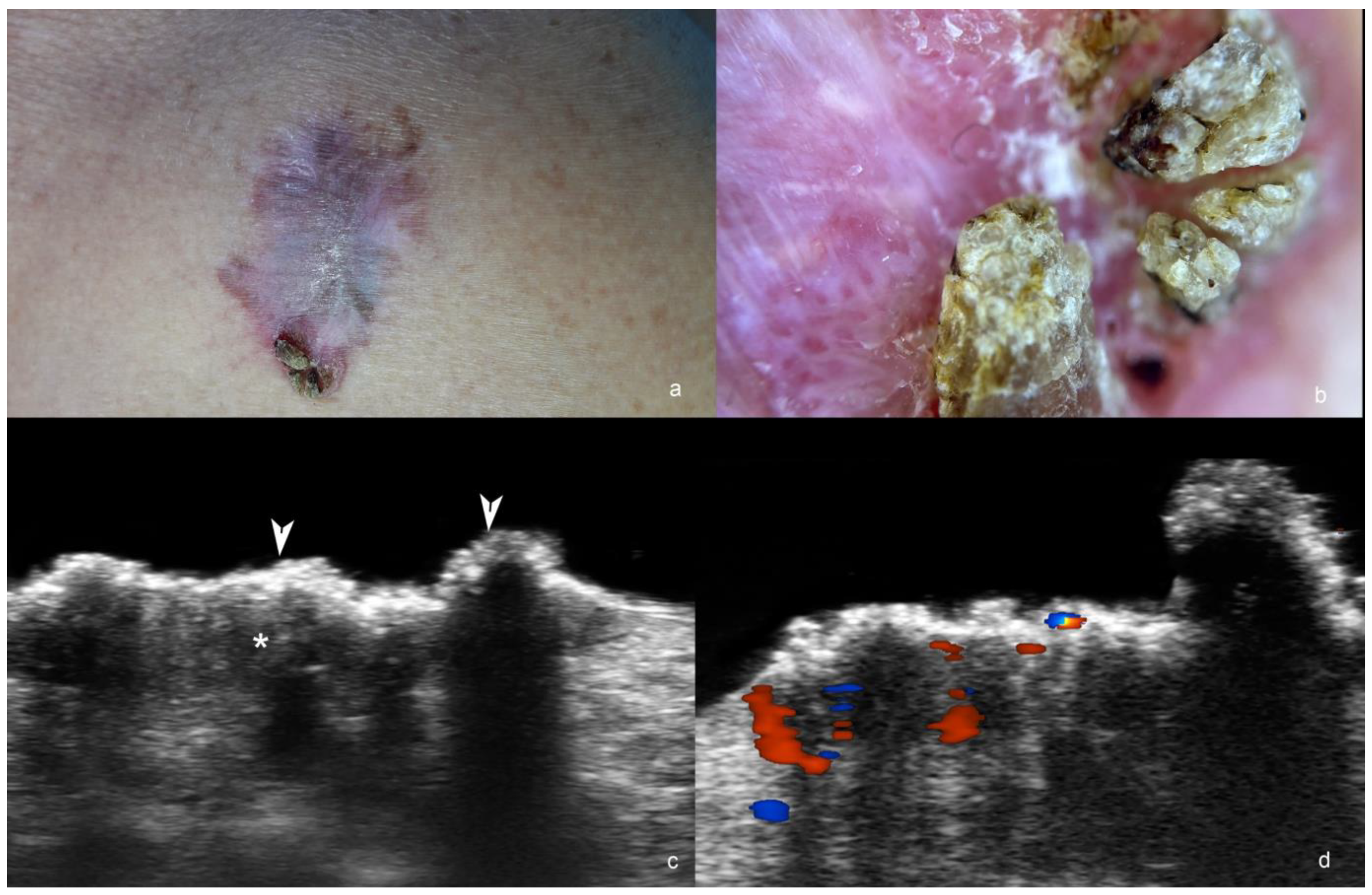 Cancers 16 03301 g003