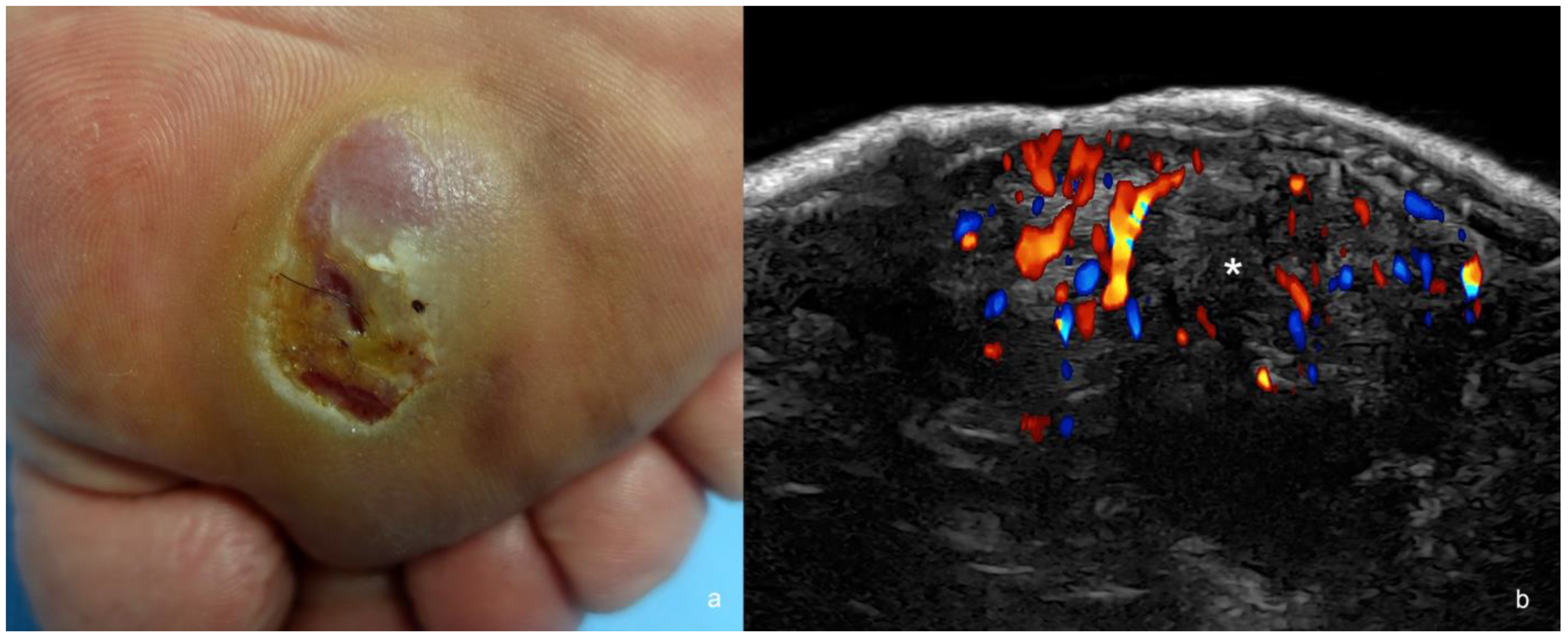 Cancers 16 03301 g005