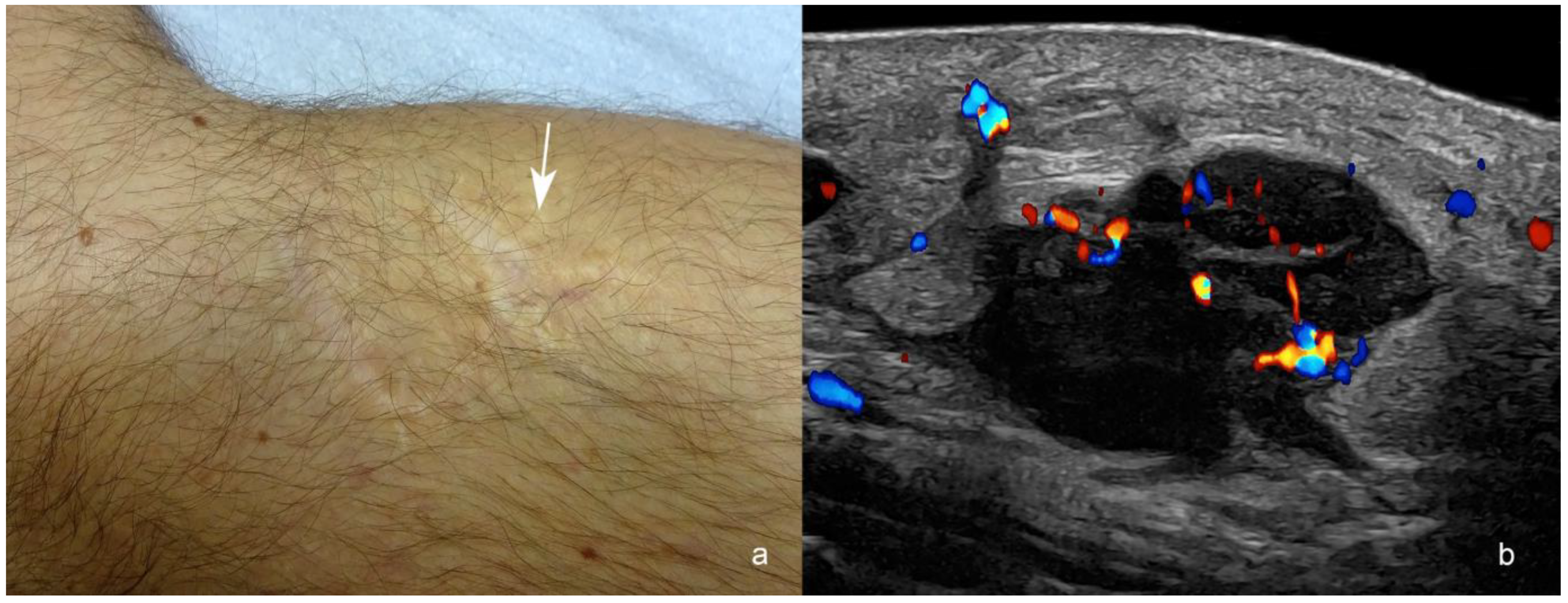 Cancers 16 03301 g006