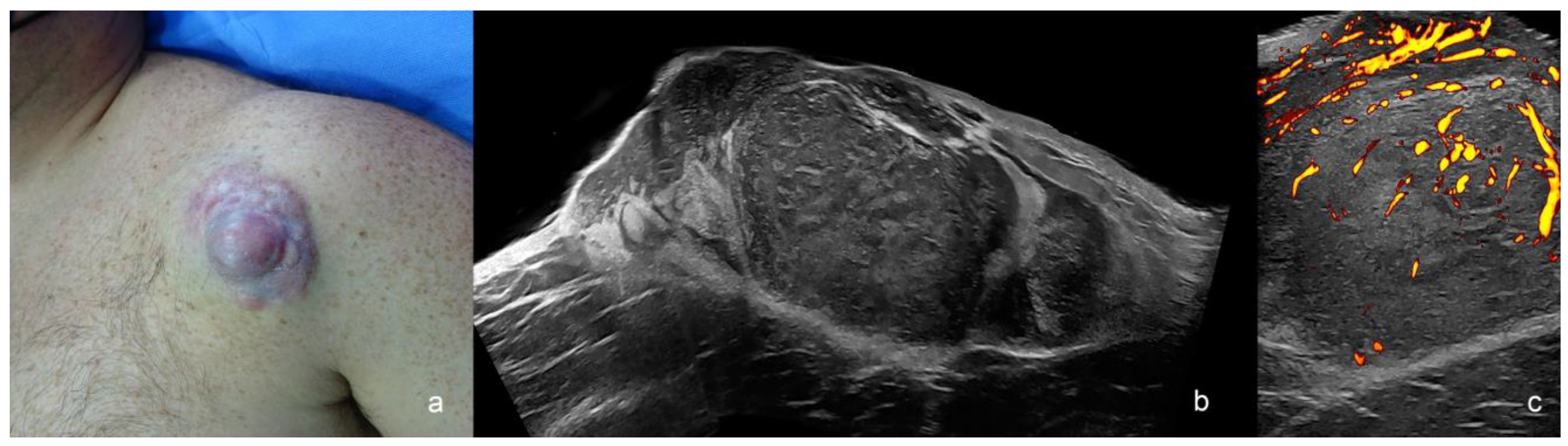 Cancers 16 03301 g007