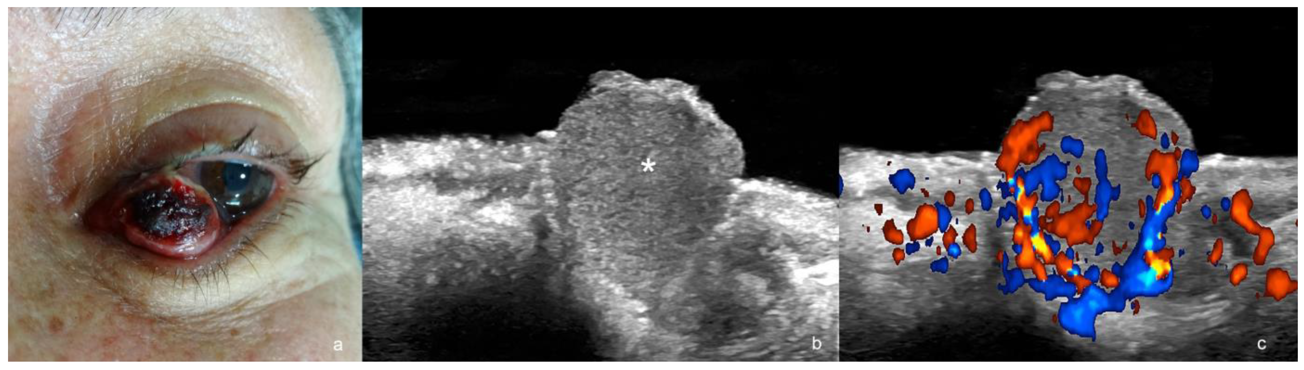 Cancers 16 03301 g008