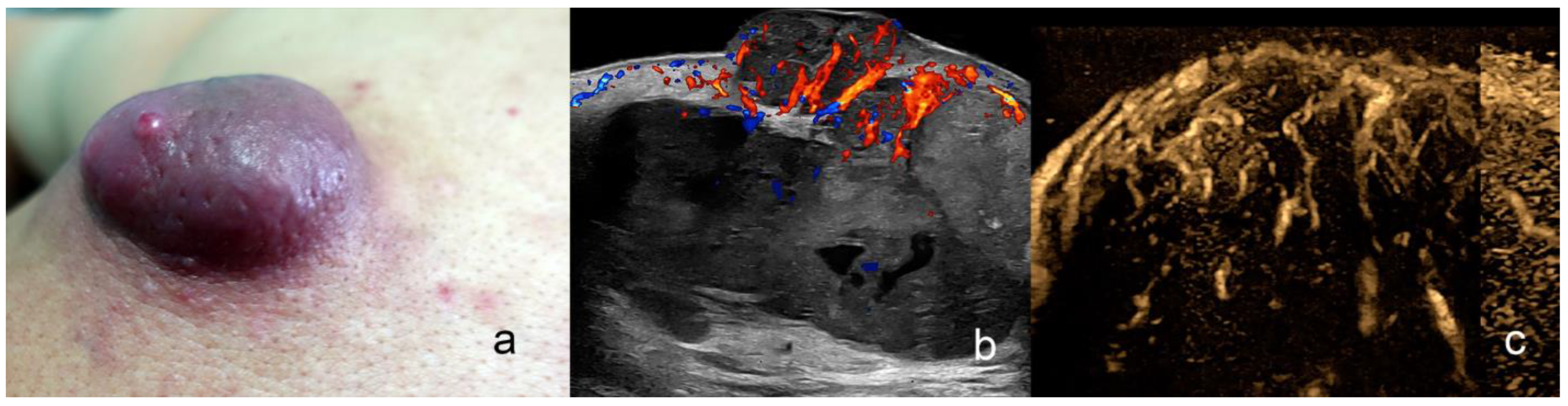 Cancers 16 03301 g010