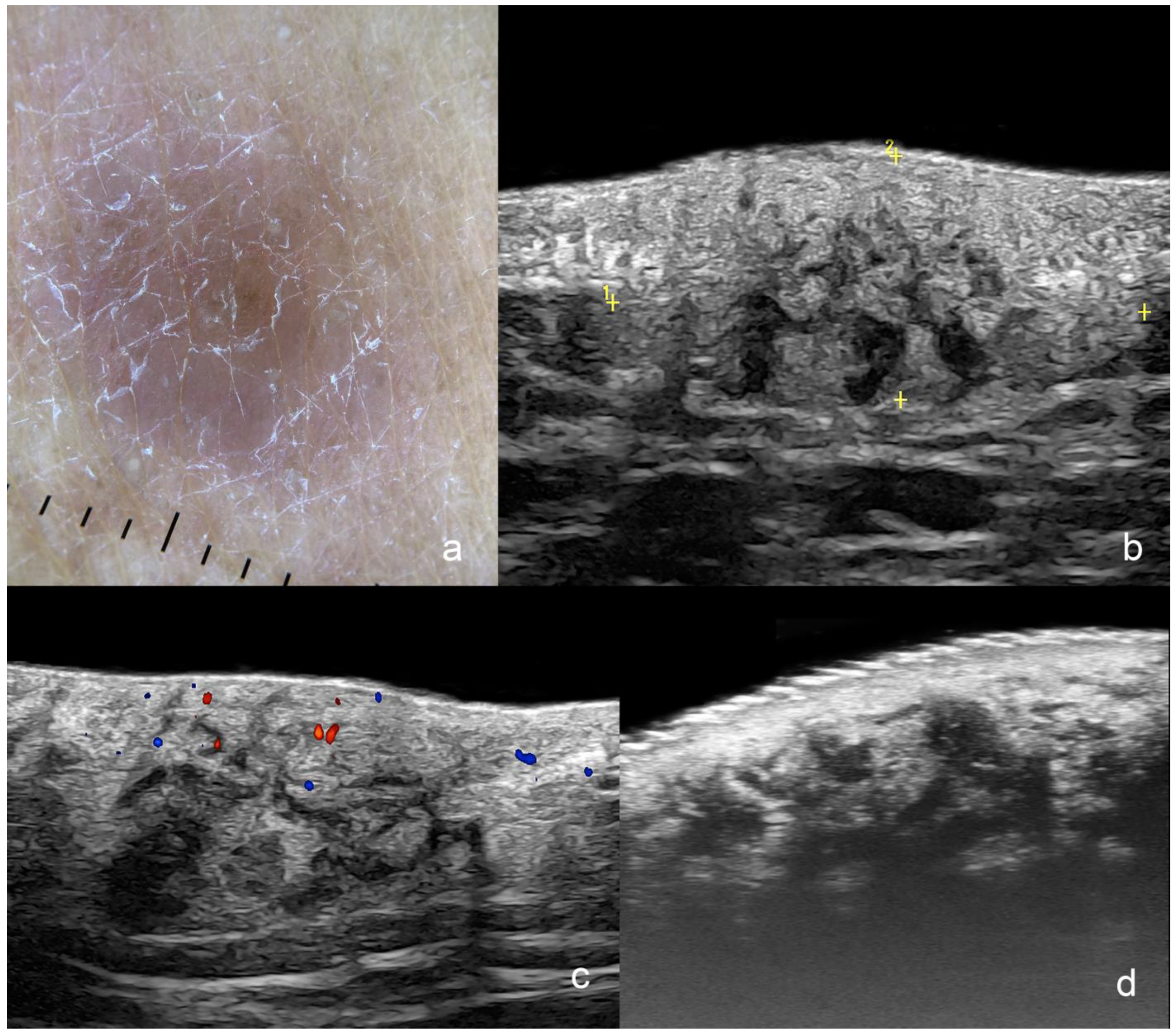 Cancers 16 03301 g011