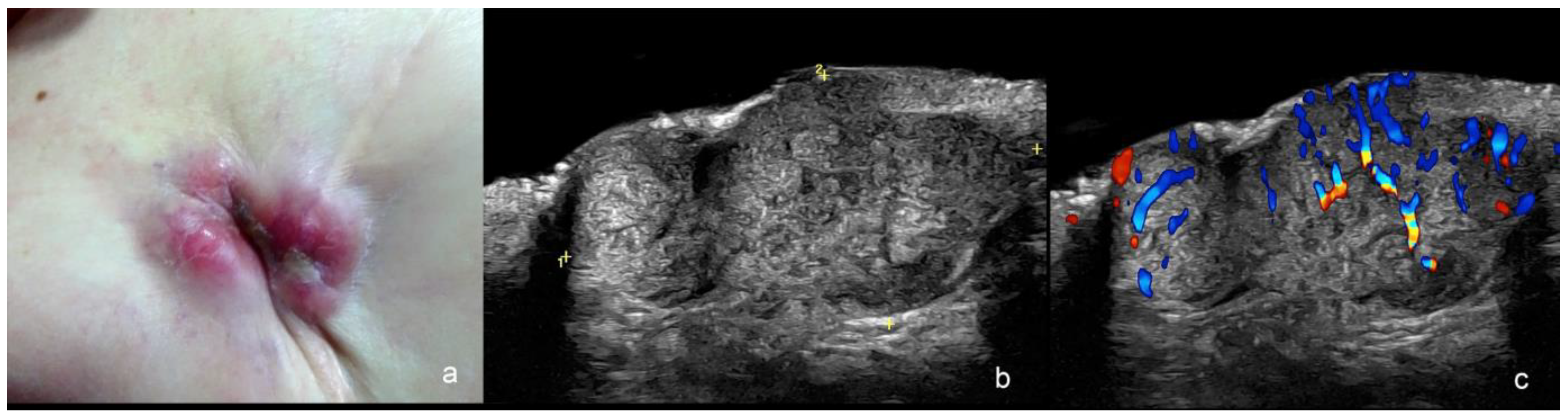 Cancers 16 03301 g012