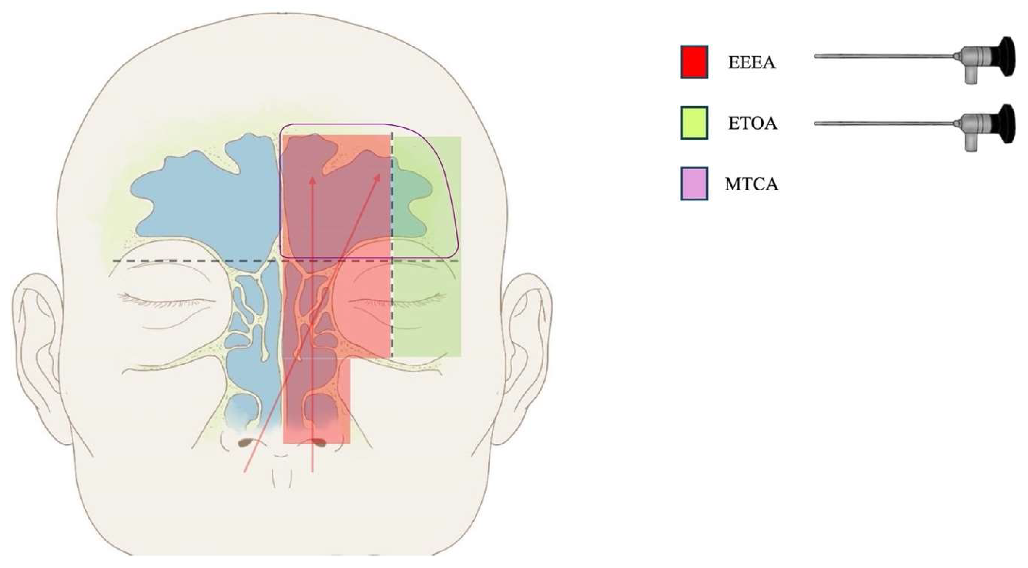 Cancers 16 03316 g004