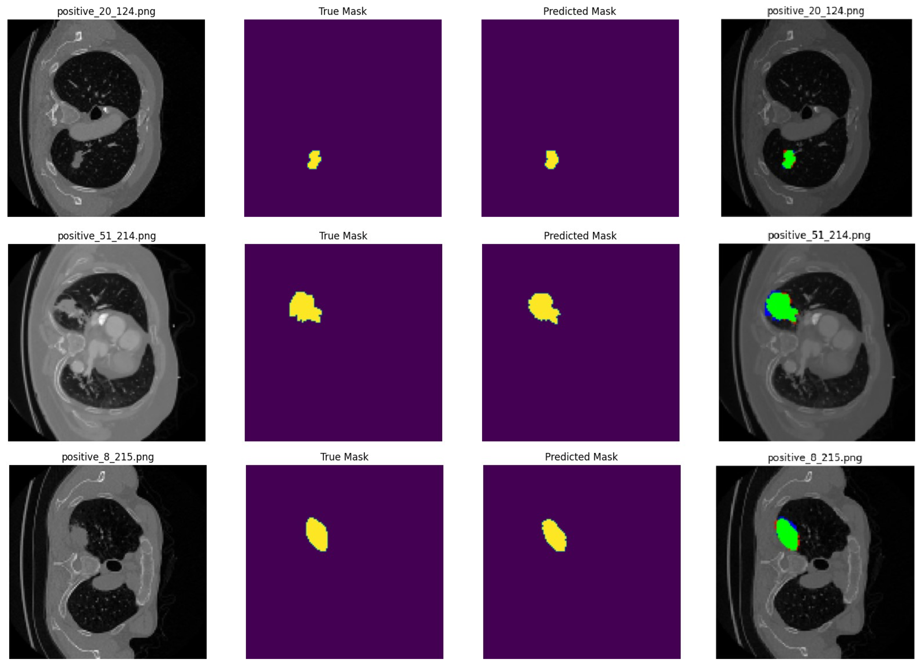 Cancers 16 03321 g003