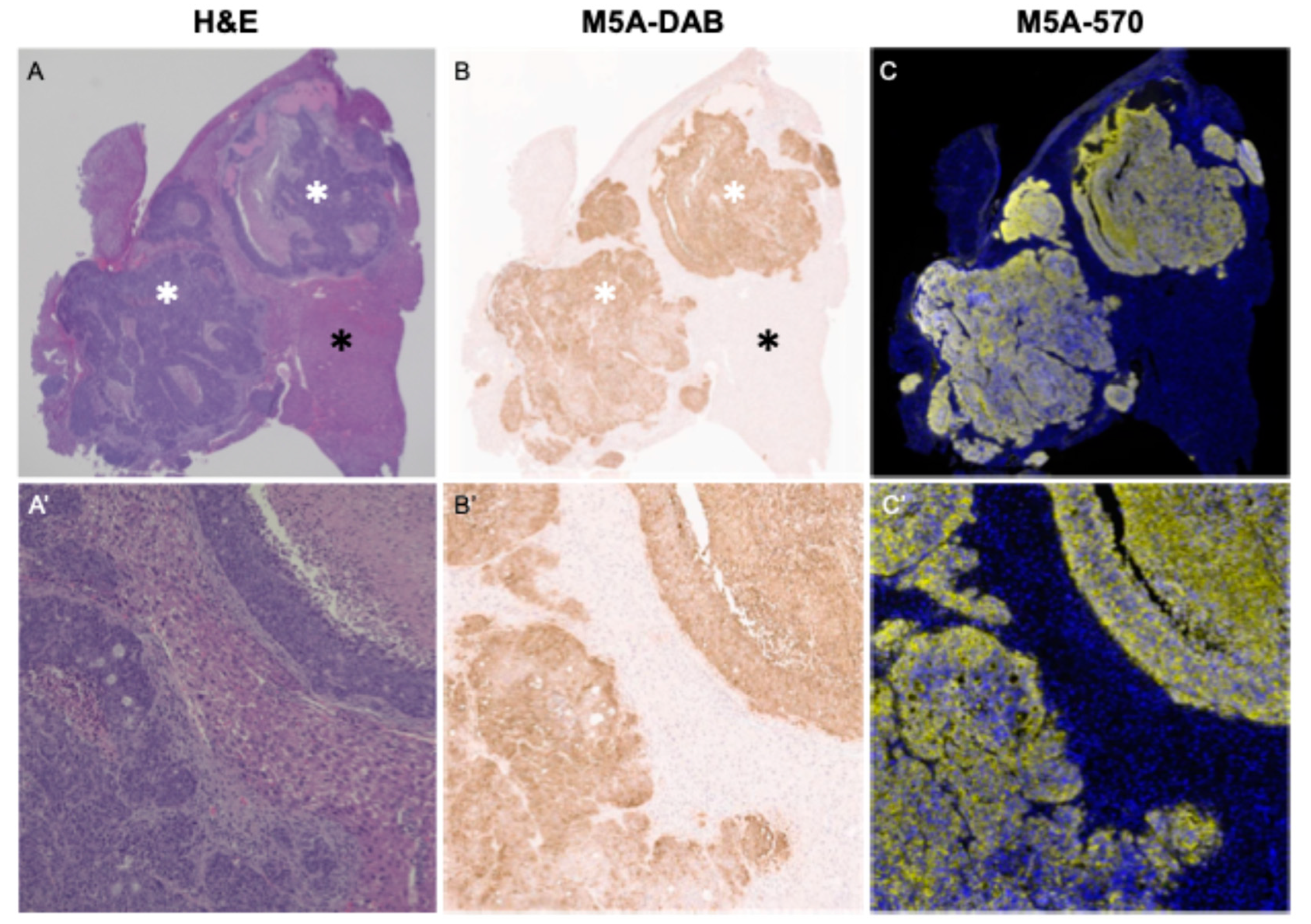 Cancers 16 03341 g008