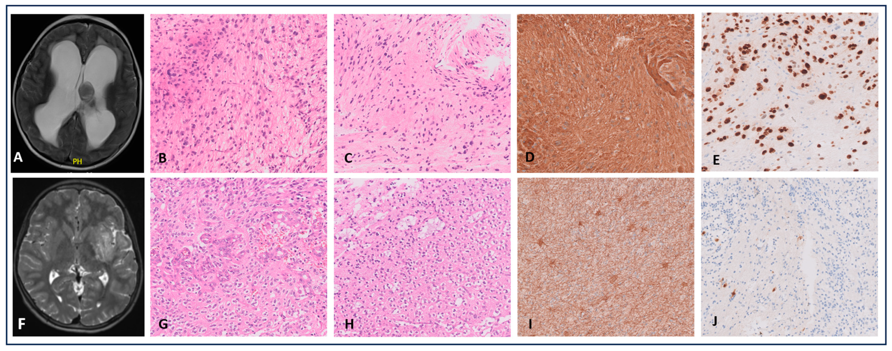 Cancers 16 03344 g002