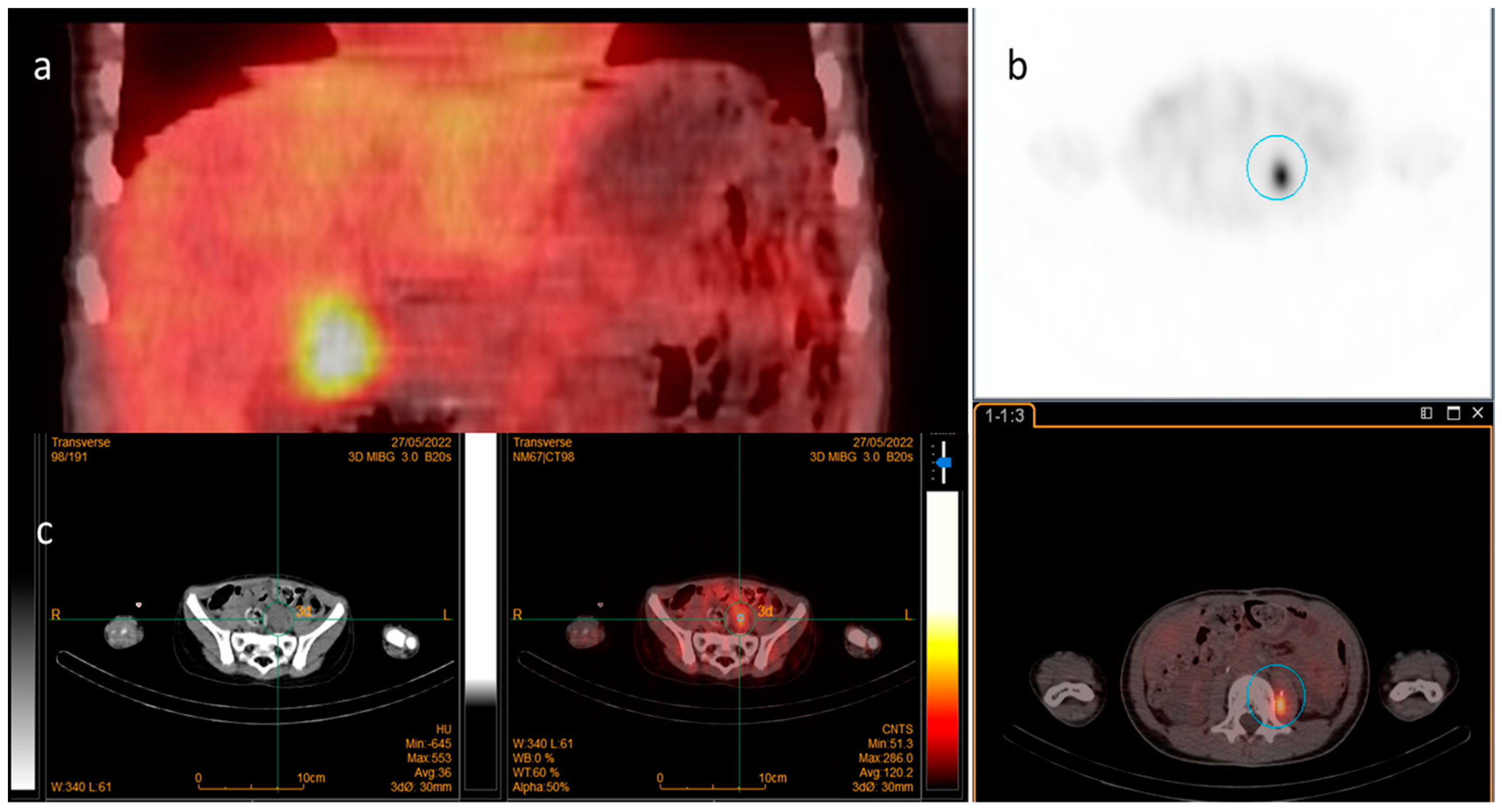 Cancers 16 03348 g001