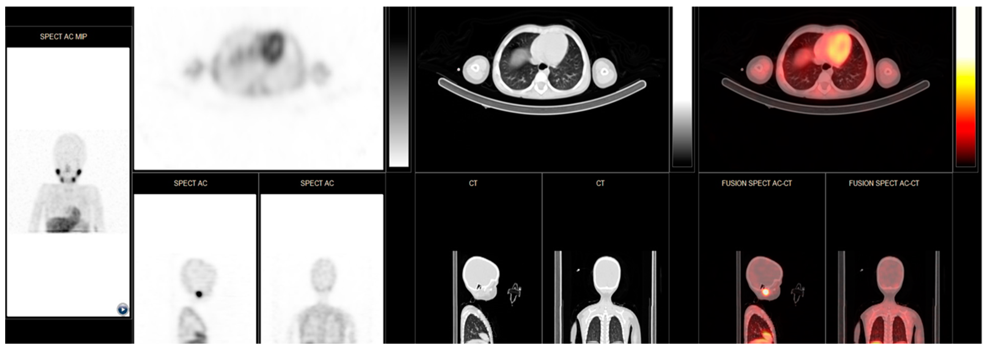 Cancers 16 03348 g003