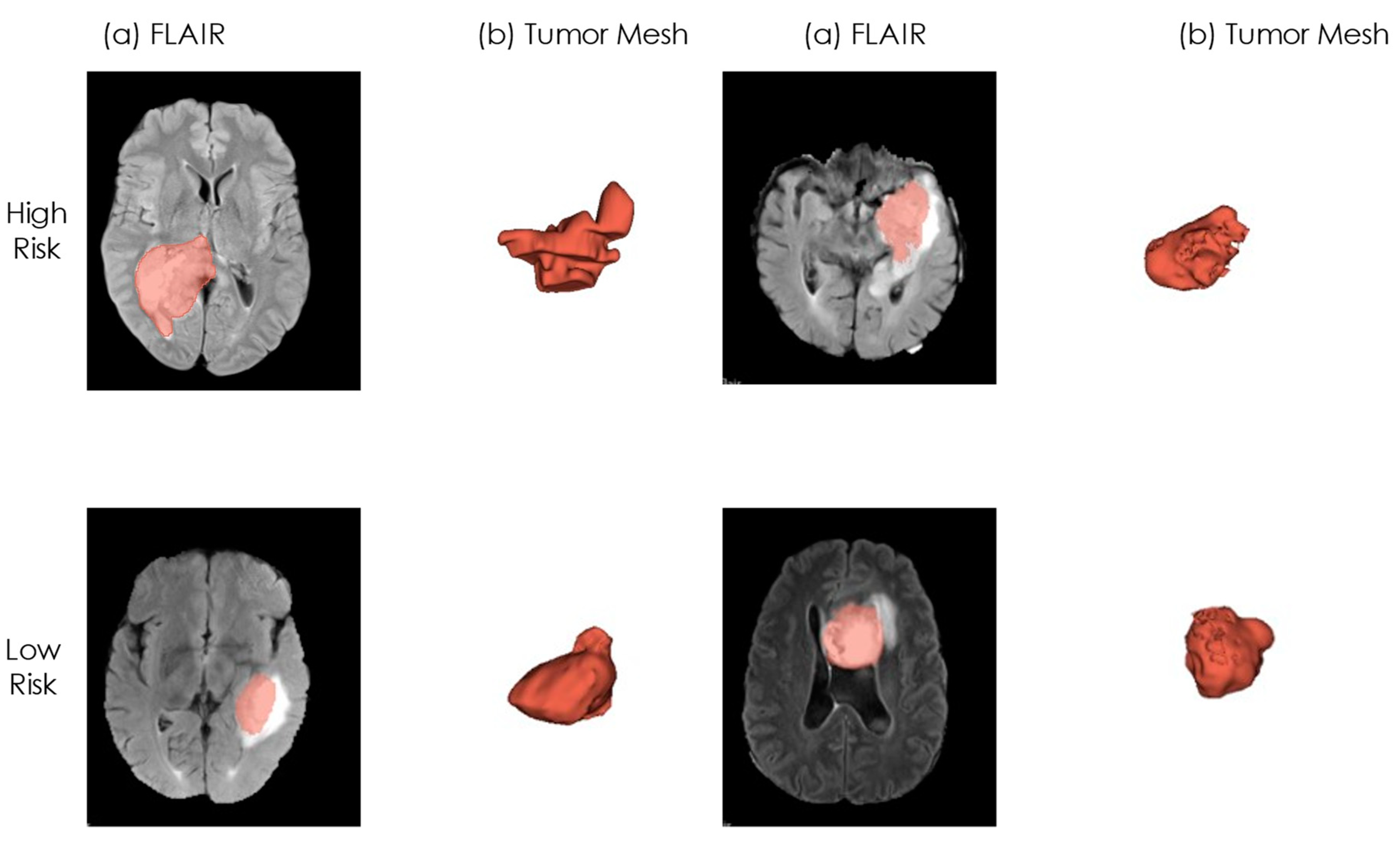 Cancers 16 03351 g005