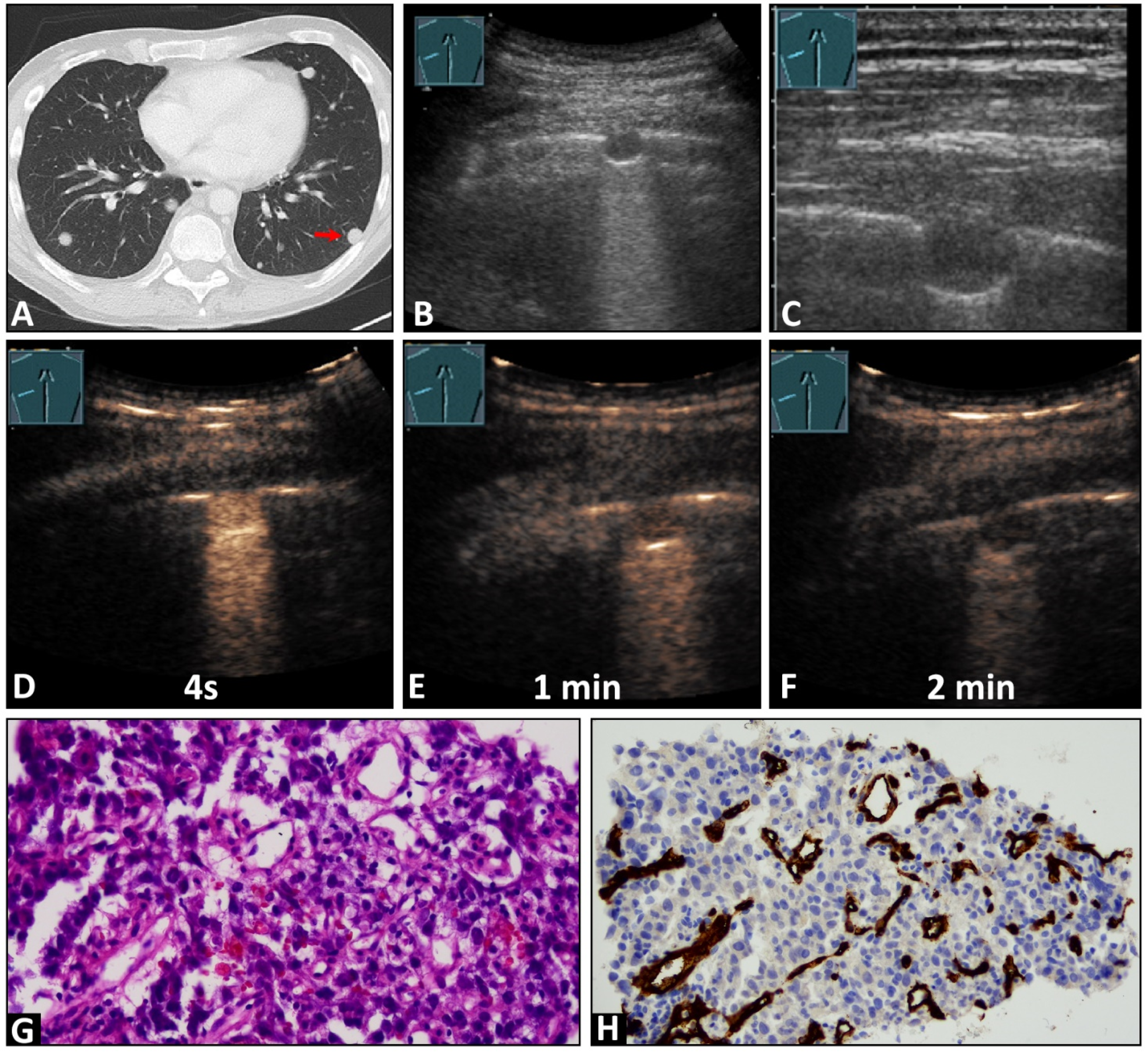 Cancers 16 03365 g002