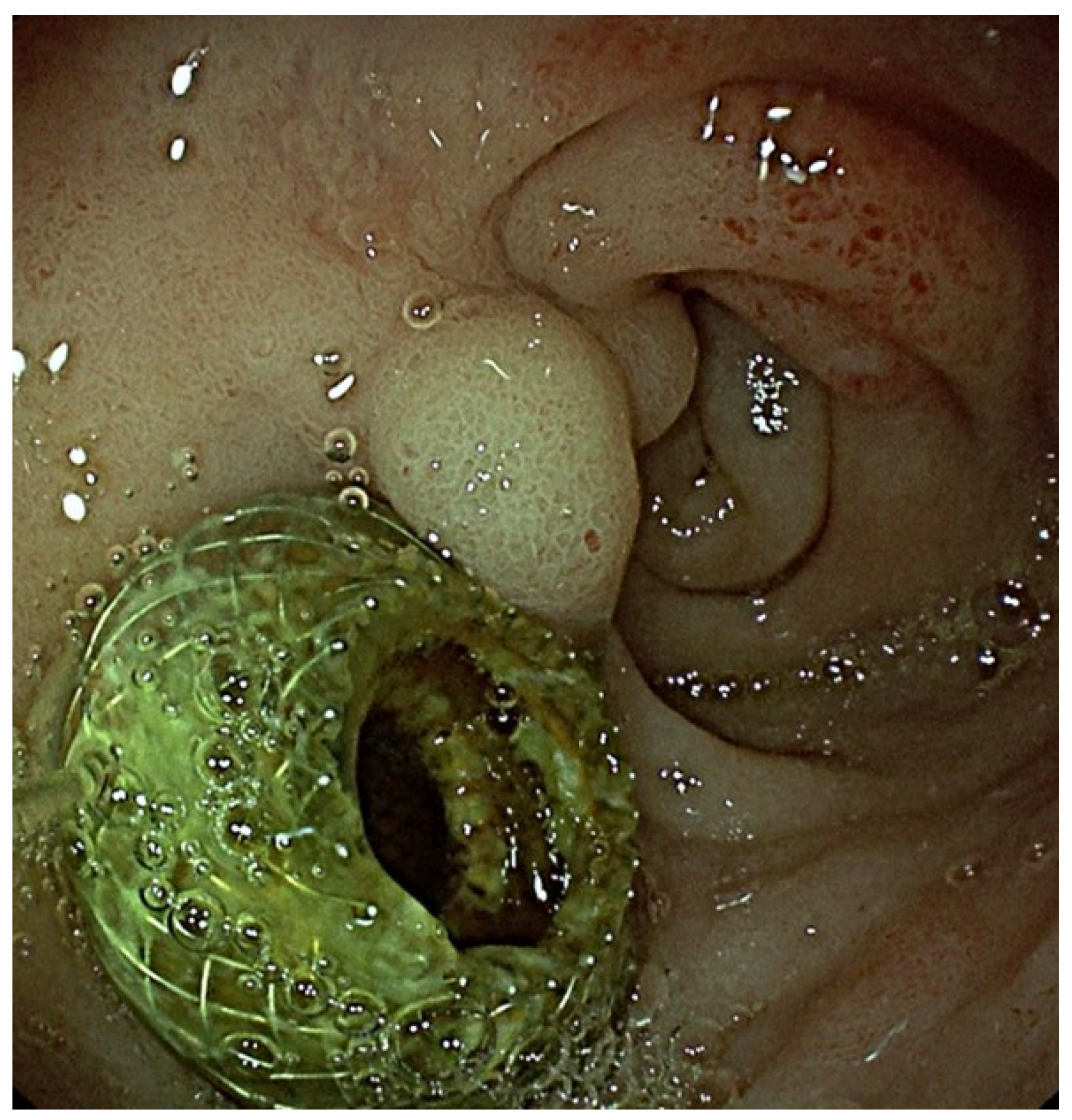 Cancers 16 03375 g001