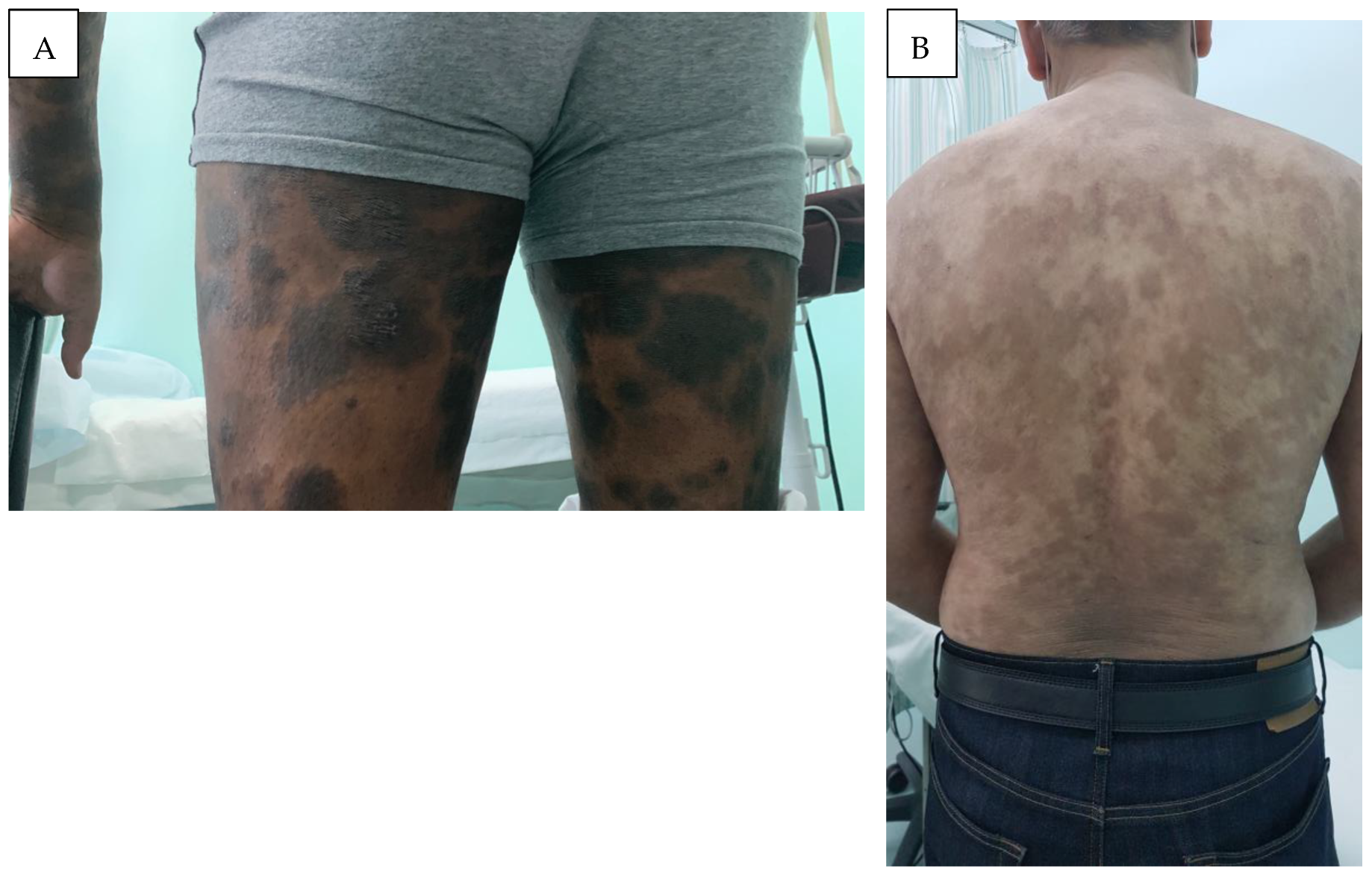 Cancers 16 03380 g002 Cancers 16 03380 g002