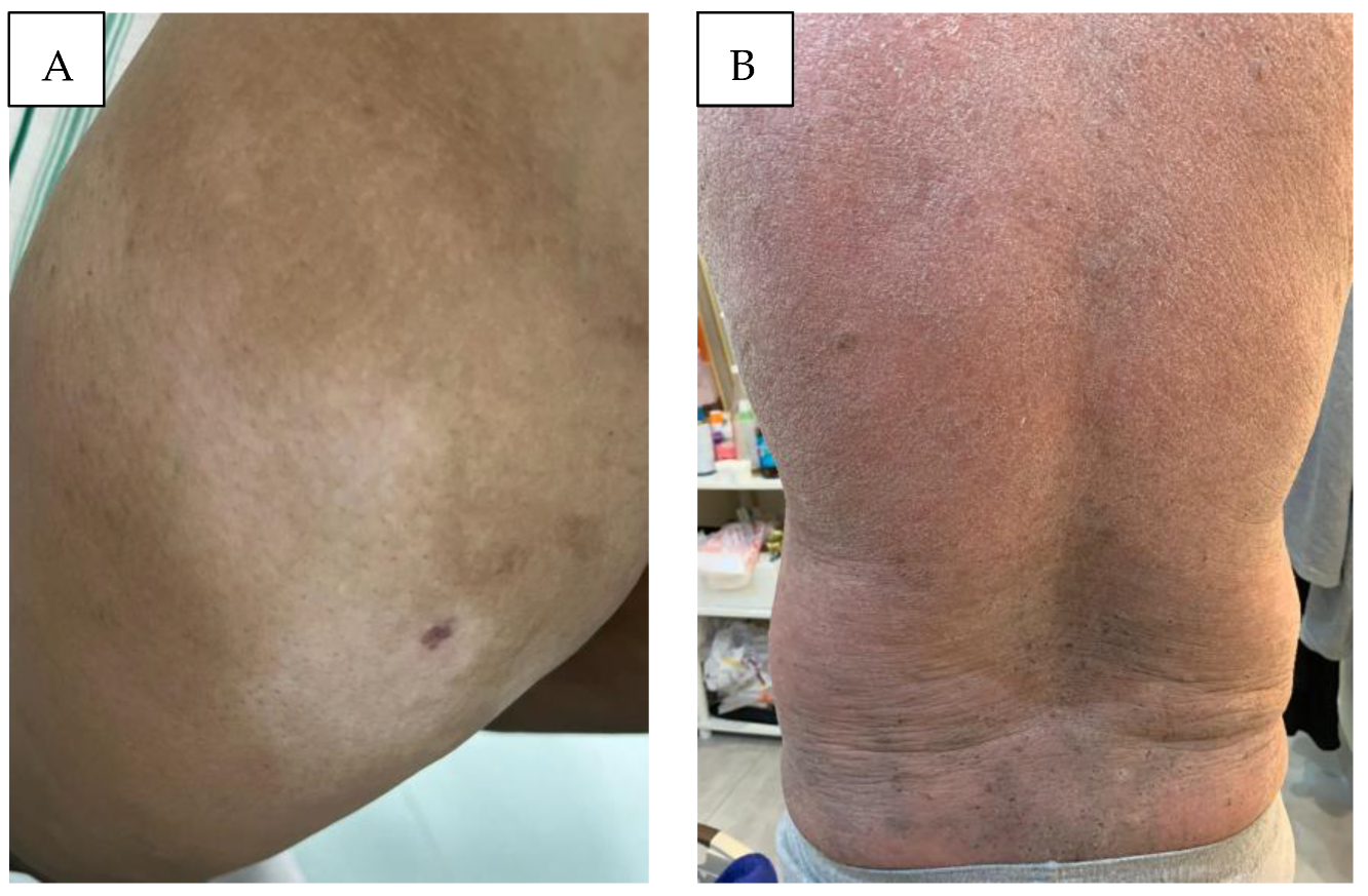 Cancers 16 03380 g003 Cancers 16 03380 g003