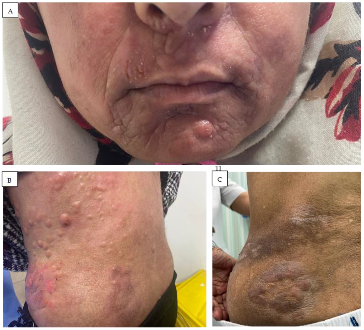 Cancers 16 03380 g004 Cancers 16 03380 g004