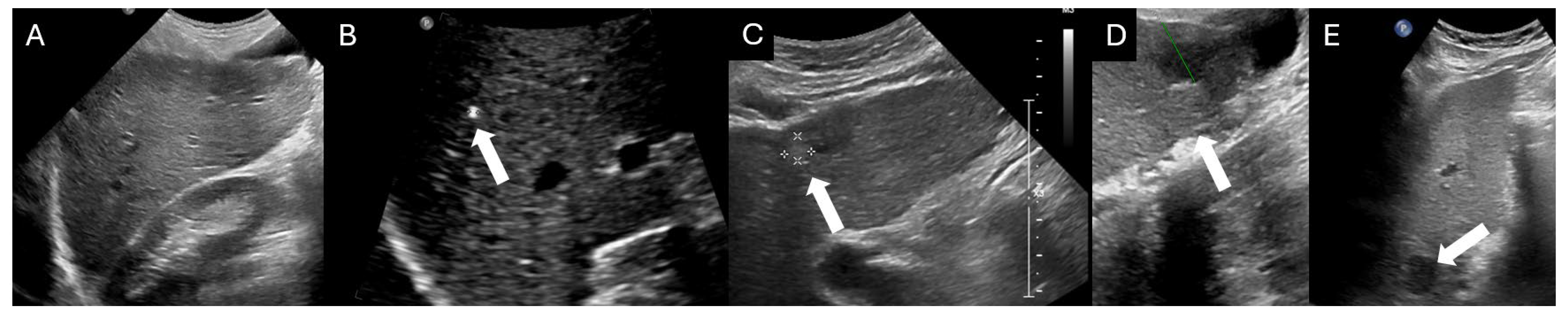 Cancers 16 03400 g001