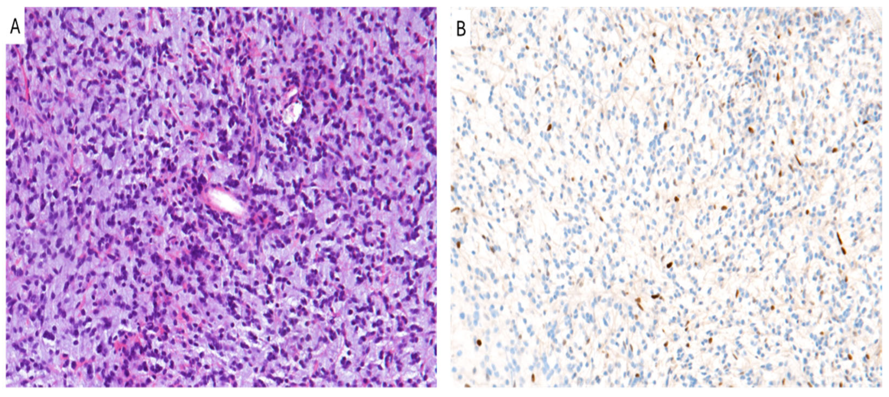 Cancers 16 03451 g001 Cancers 16 03451 g001