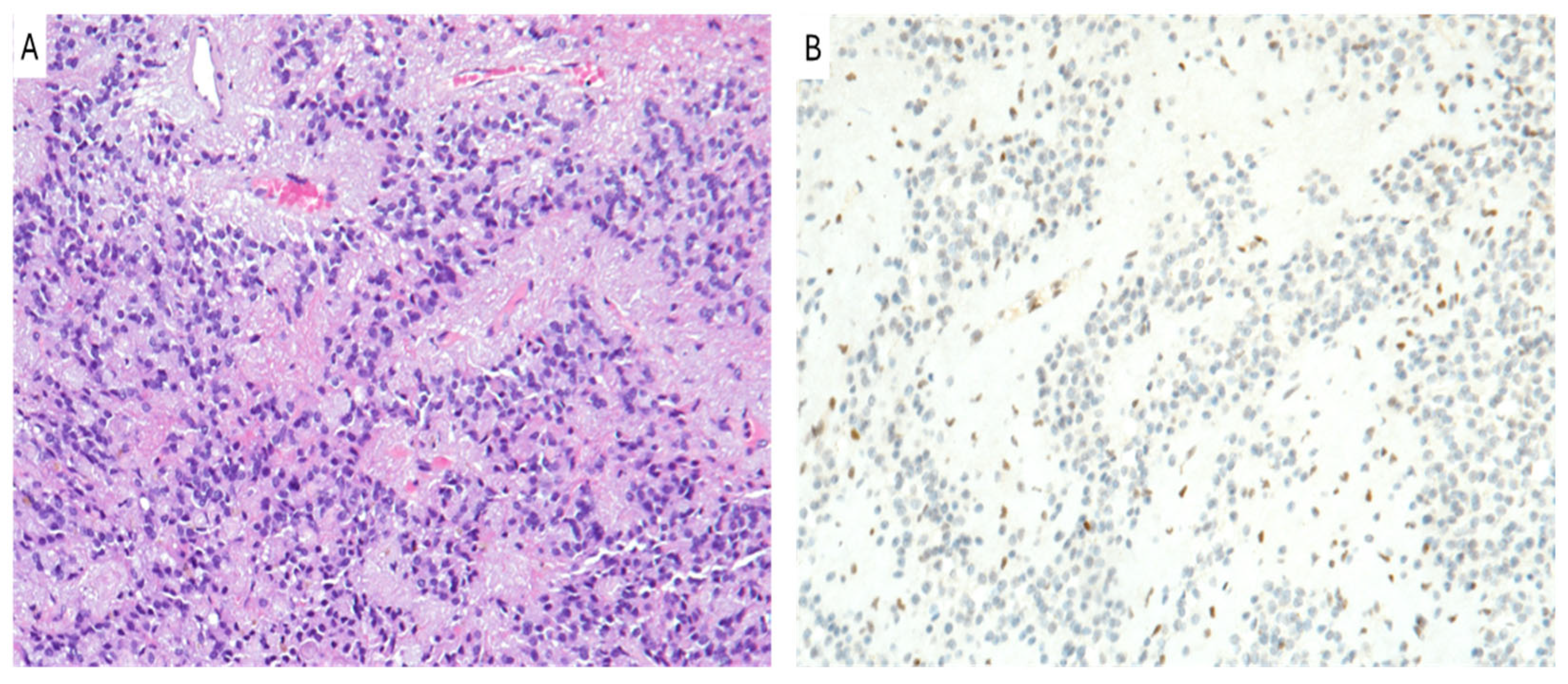 Cancers 16 03451 g002 Cancers 16 03451 g002