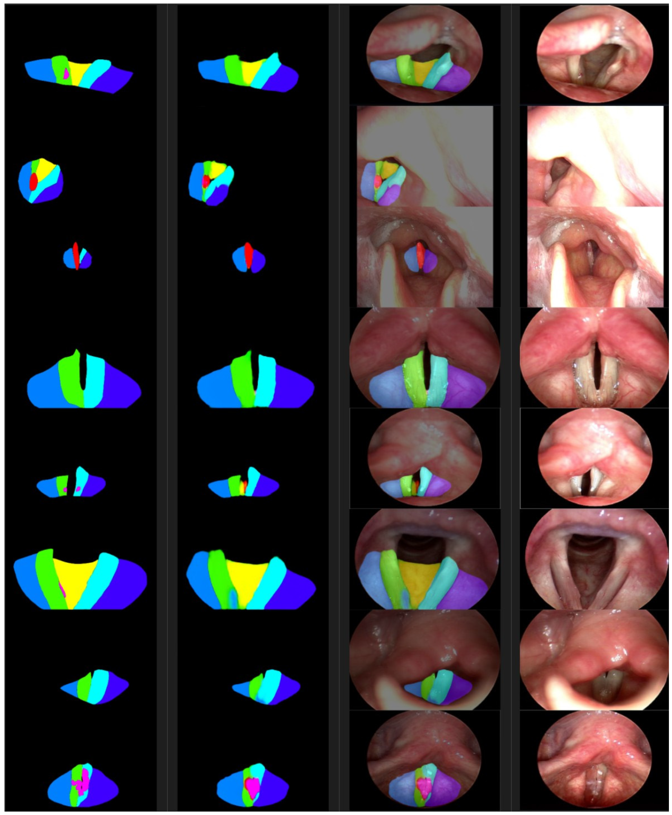 Cancers 16 03482 g005