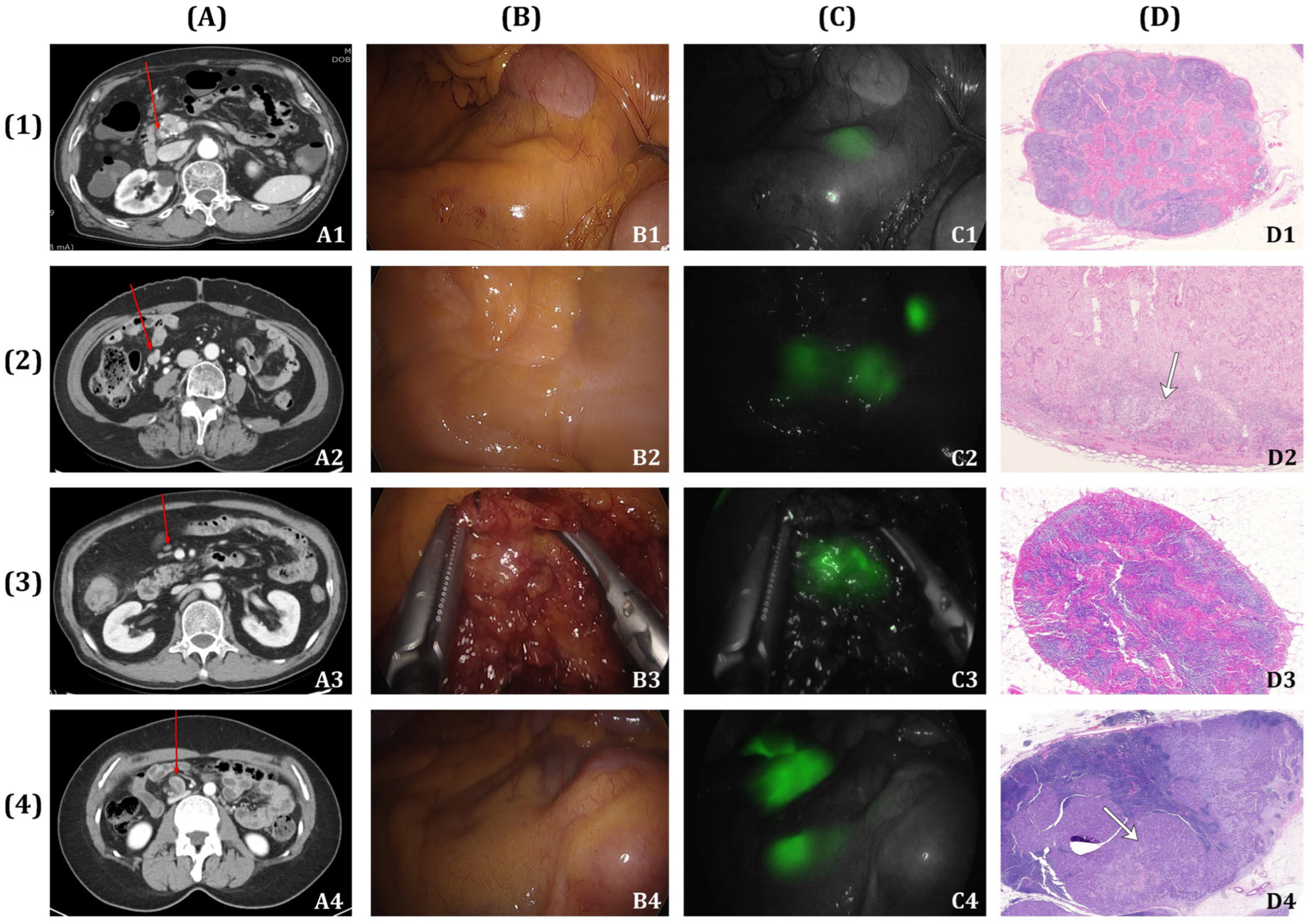 Cancers 16 03496 g002