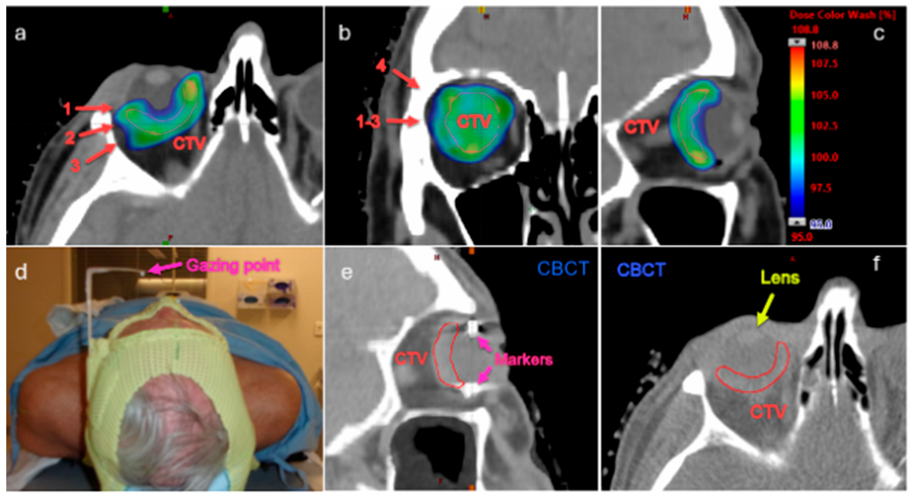 Cancers 16 03497 g002