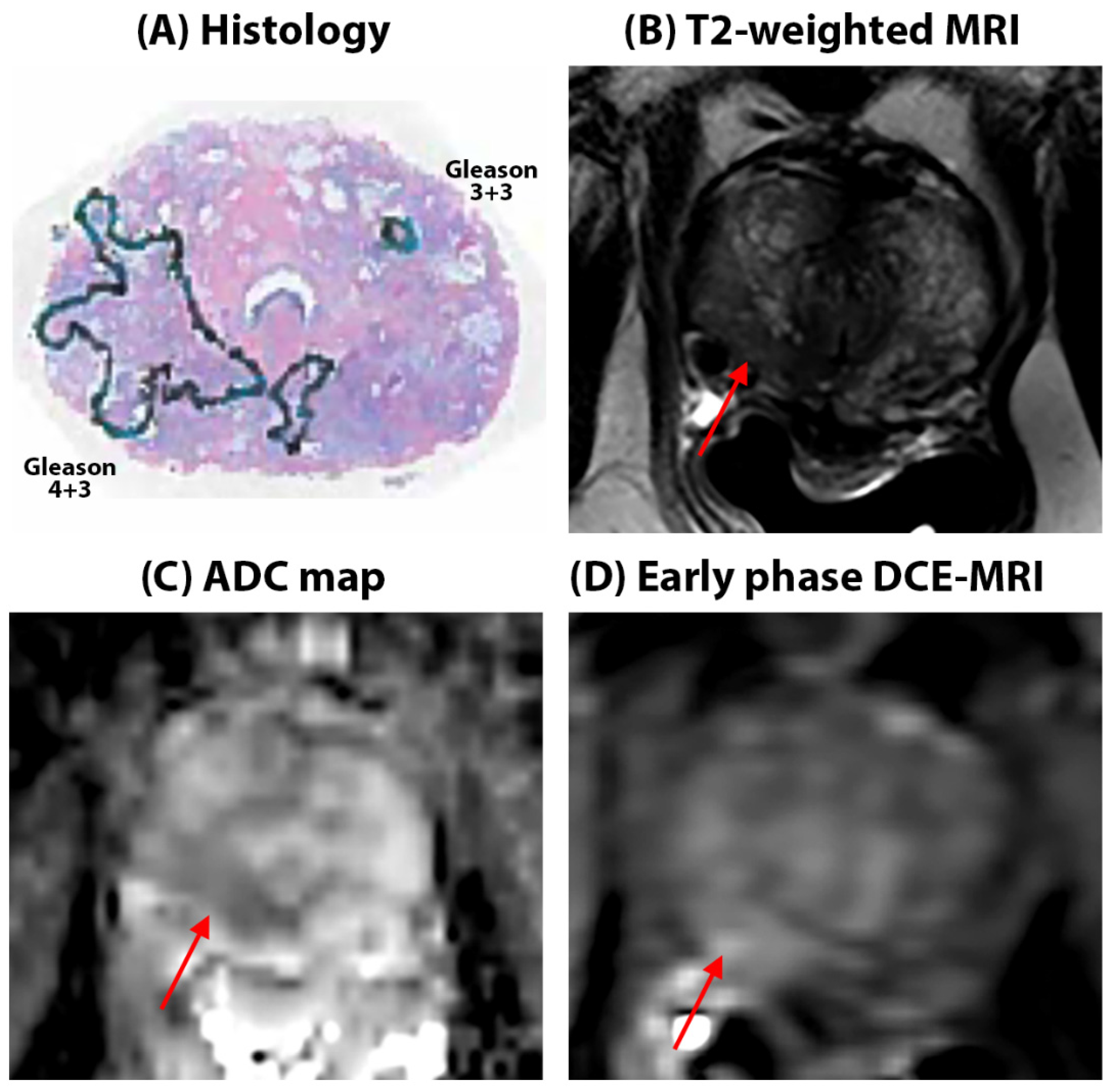 Cancers 16 03499 g002