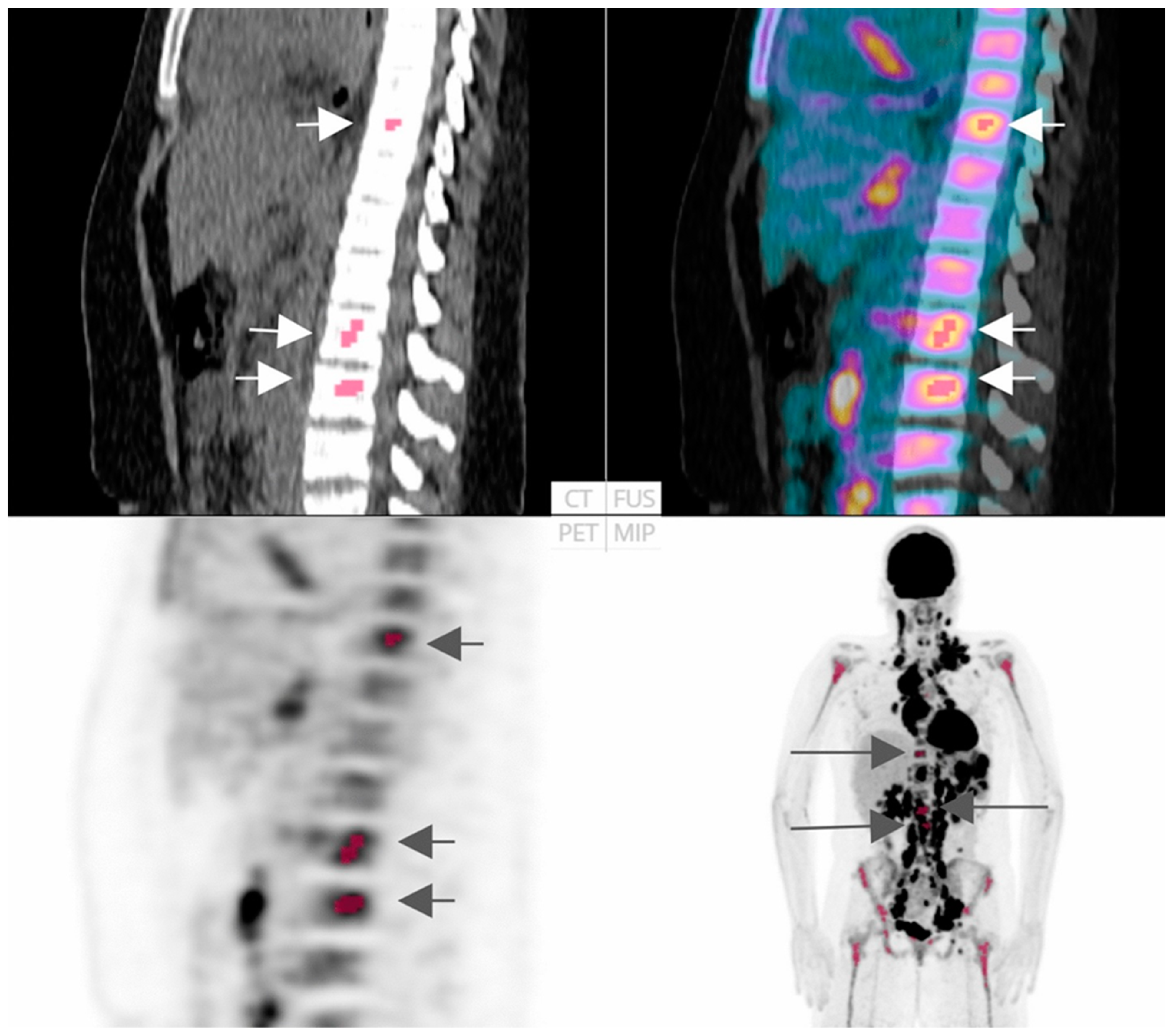 Cancers 16 03511 g004 Cancers 16 03511 g004