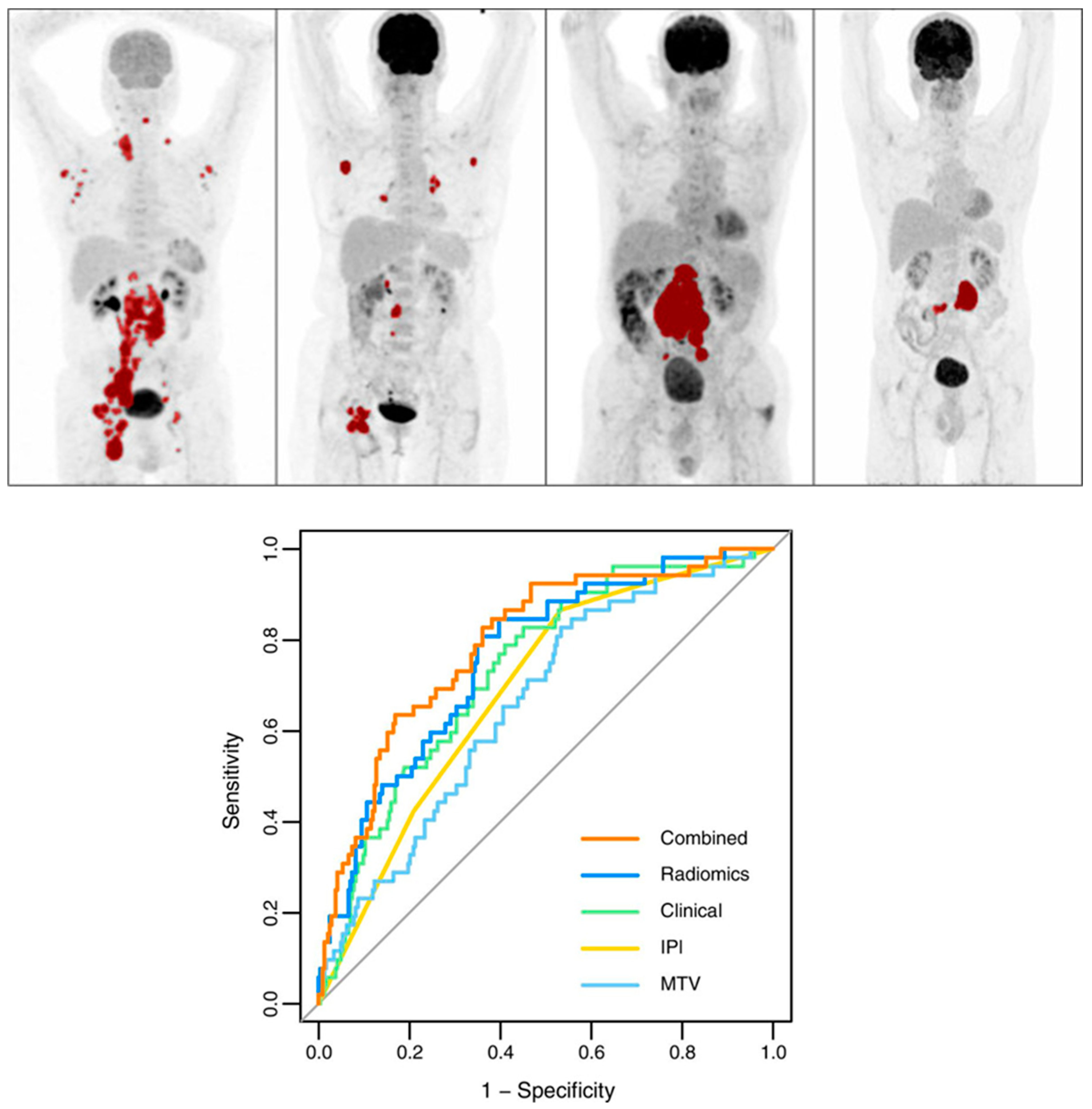 Cancers 16 03511 g005 Cancers 16 03511 g005