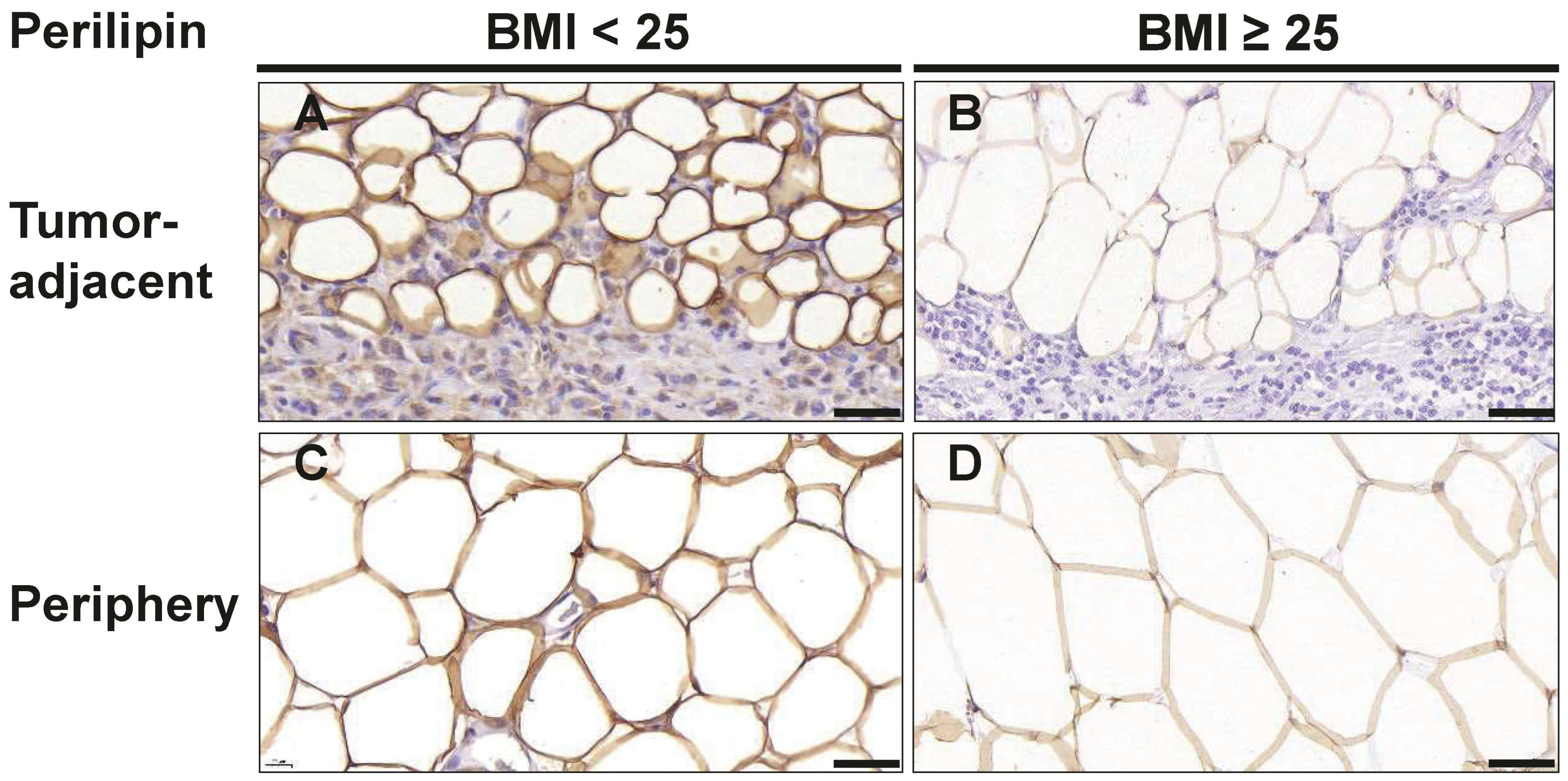 Cancers 16 03515 g004