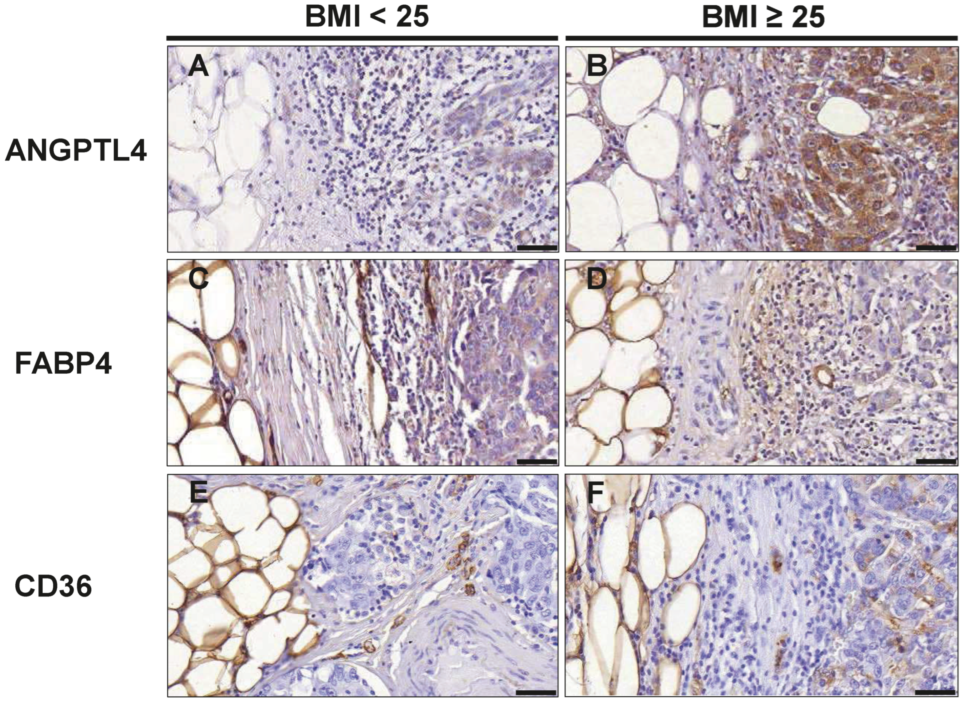 Cancers 16 03515 g005