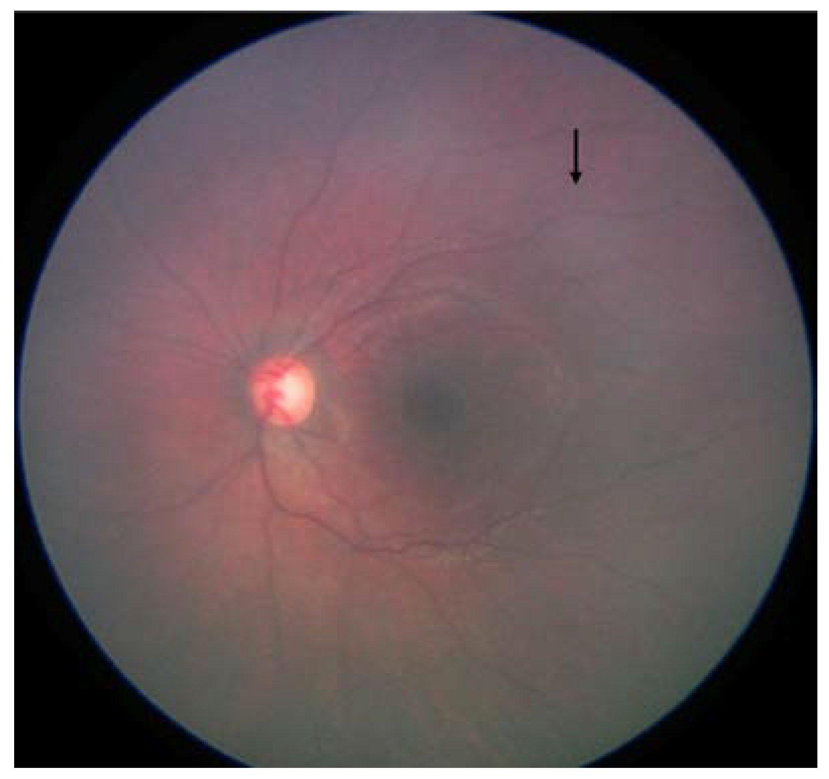 Cancers 16 03516 g002