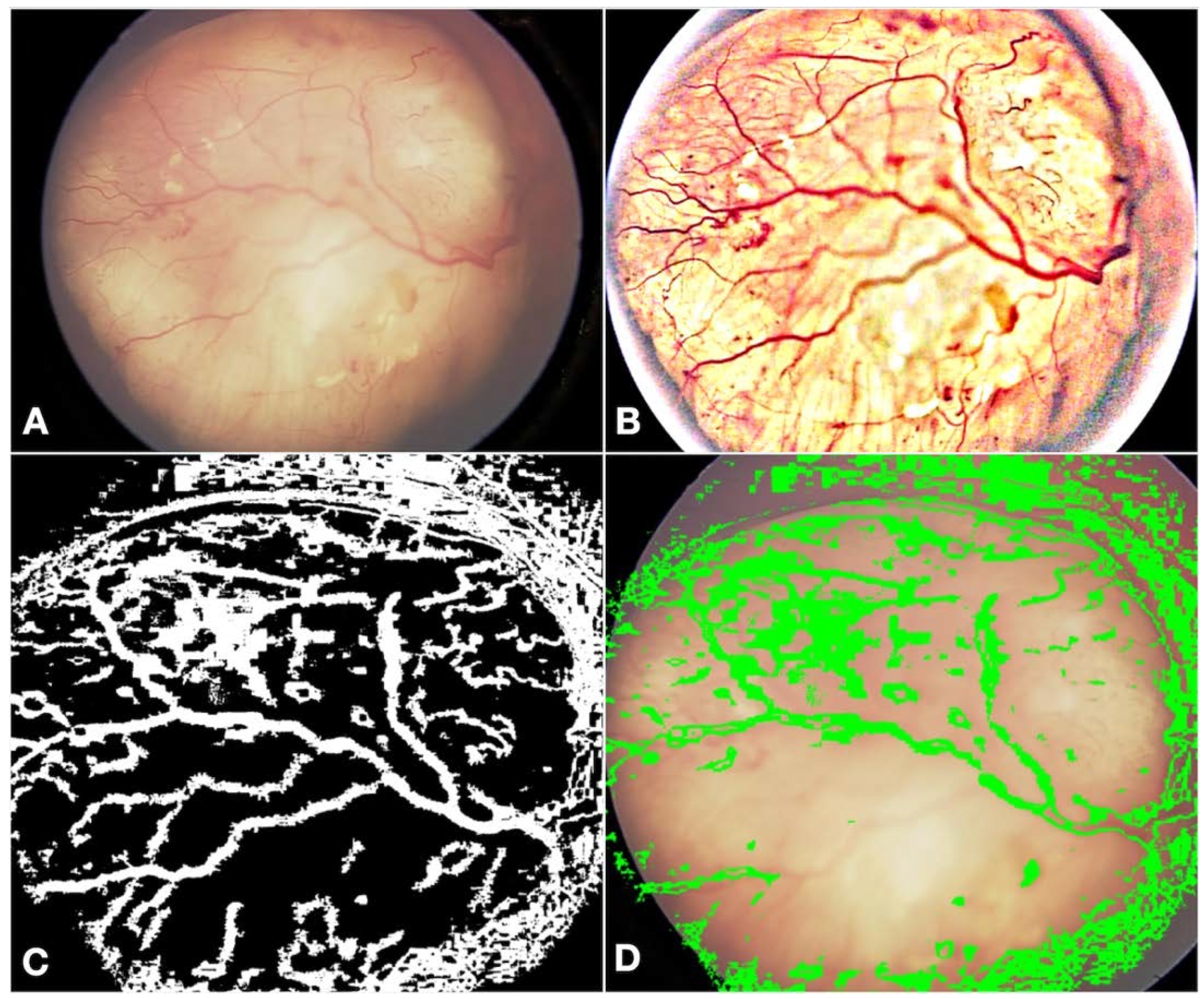 Cancers 16 03516 g003