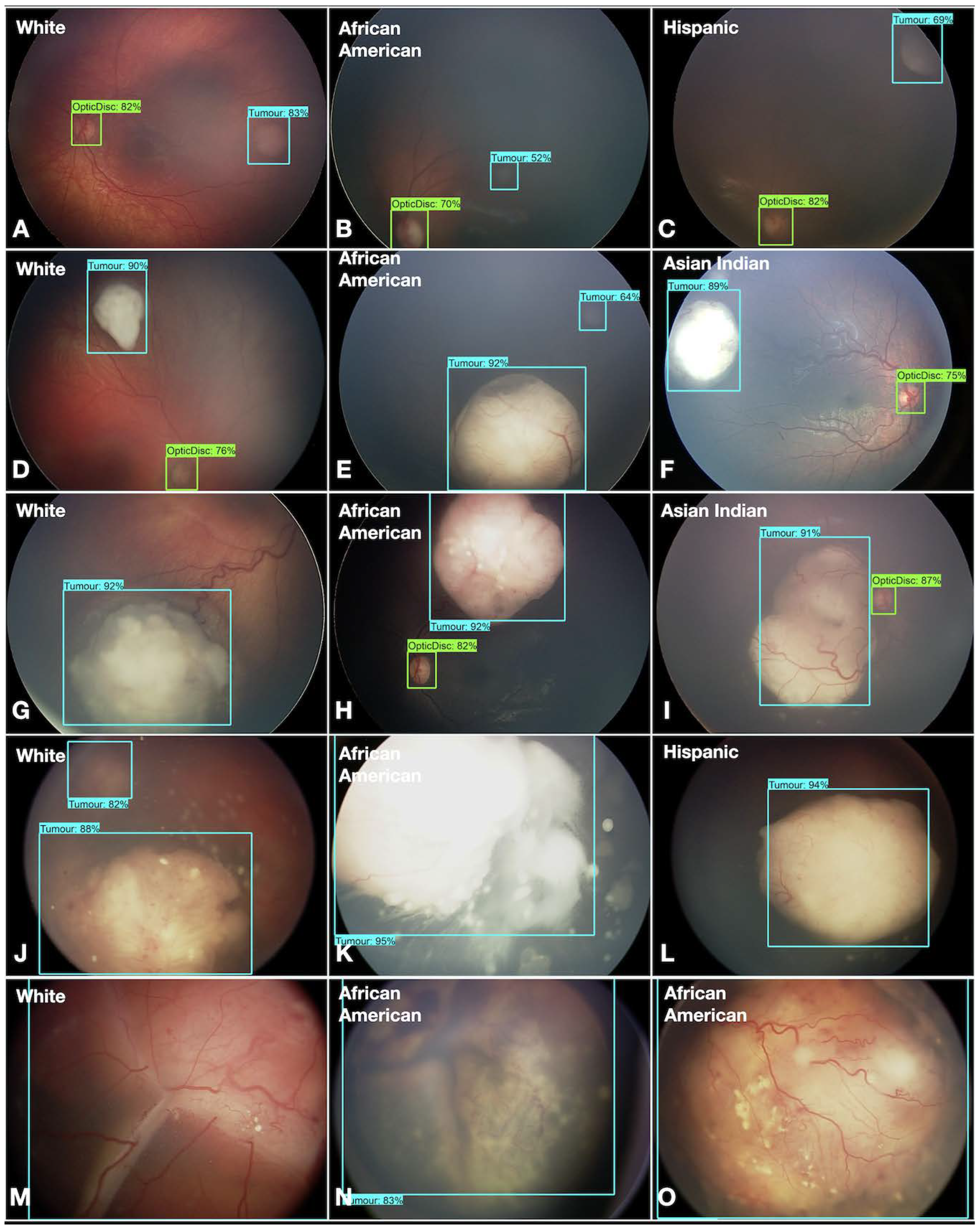 Cancers 16 03516 g005