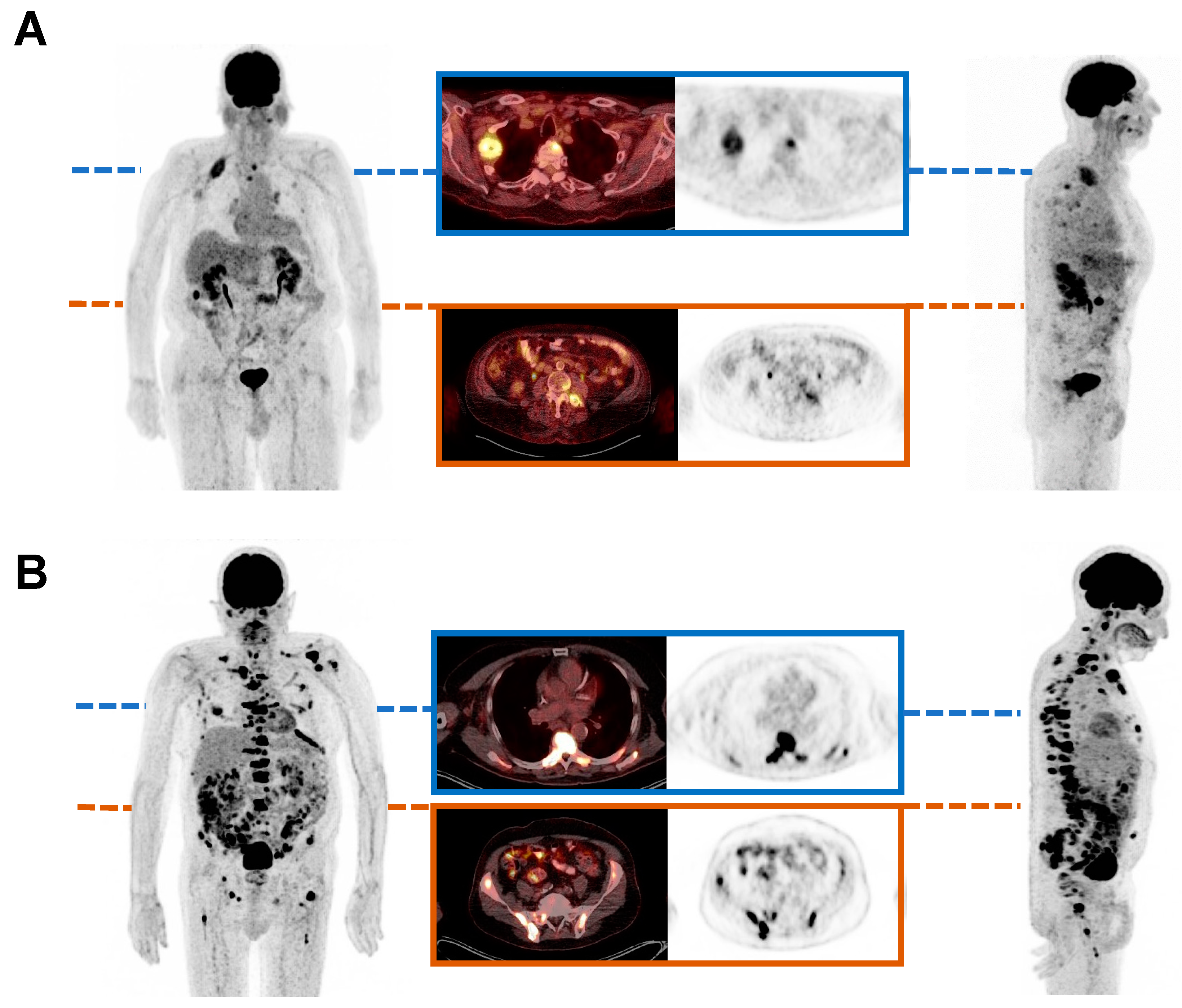 Cancers 16 03532 g005