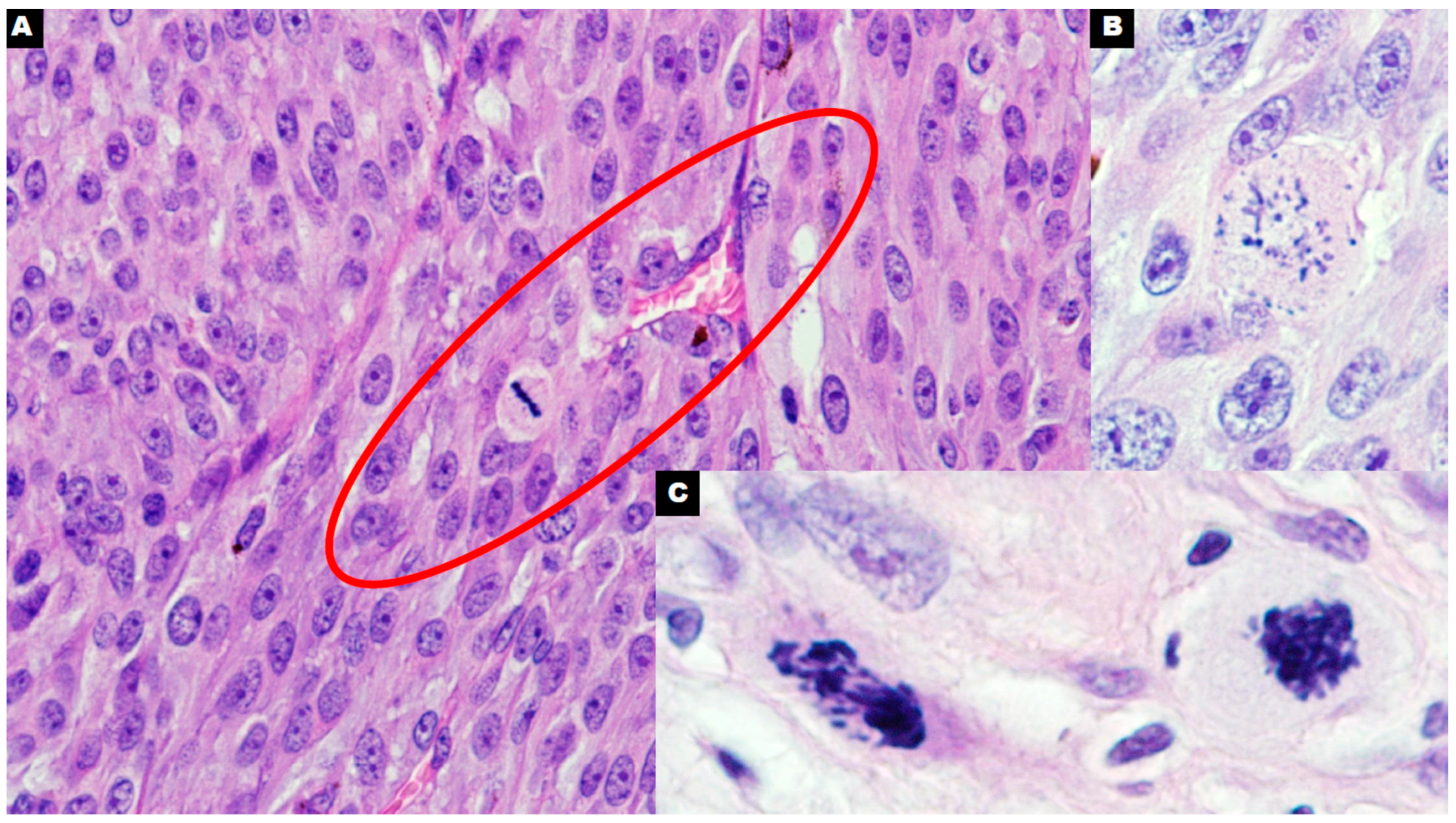 Cancers 16 03539 g002