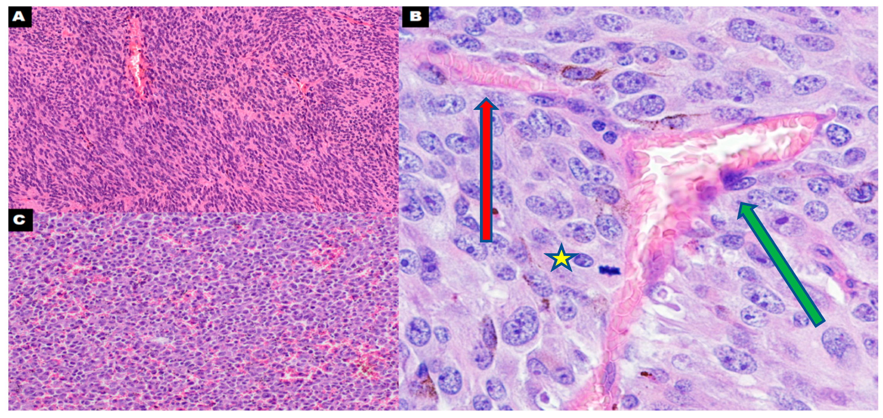Cancers 16 03539 g004