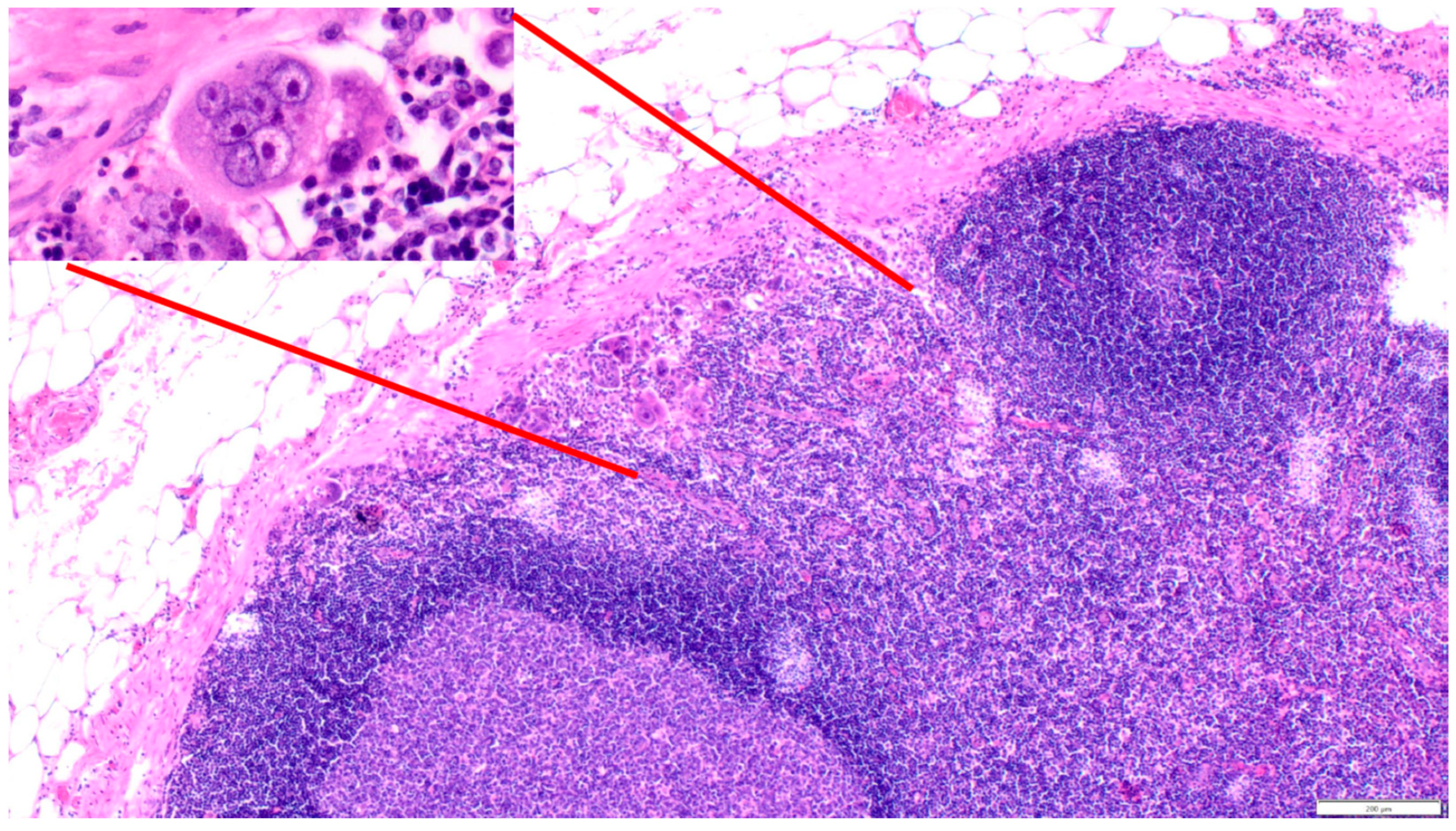 Cancers 16 03539 g007