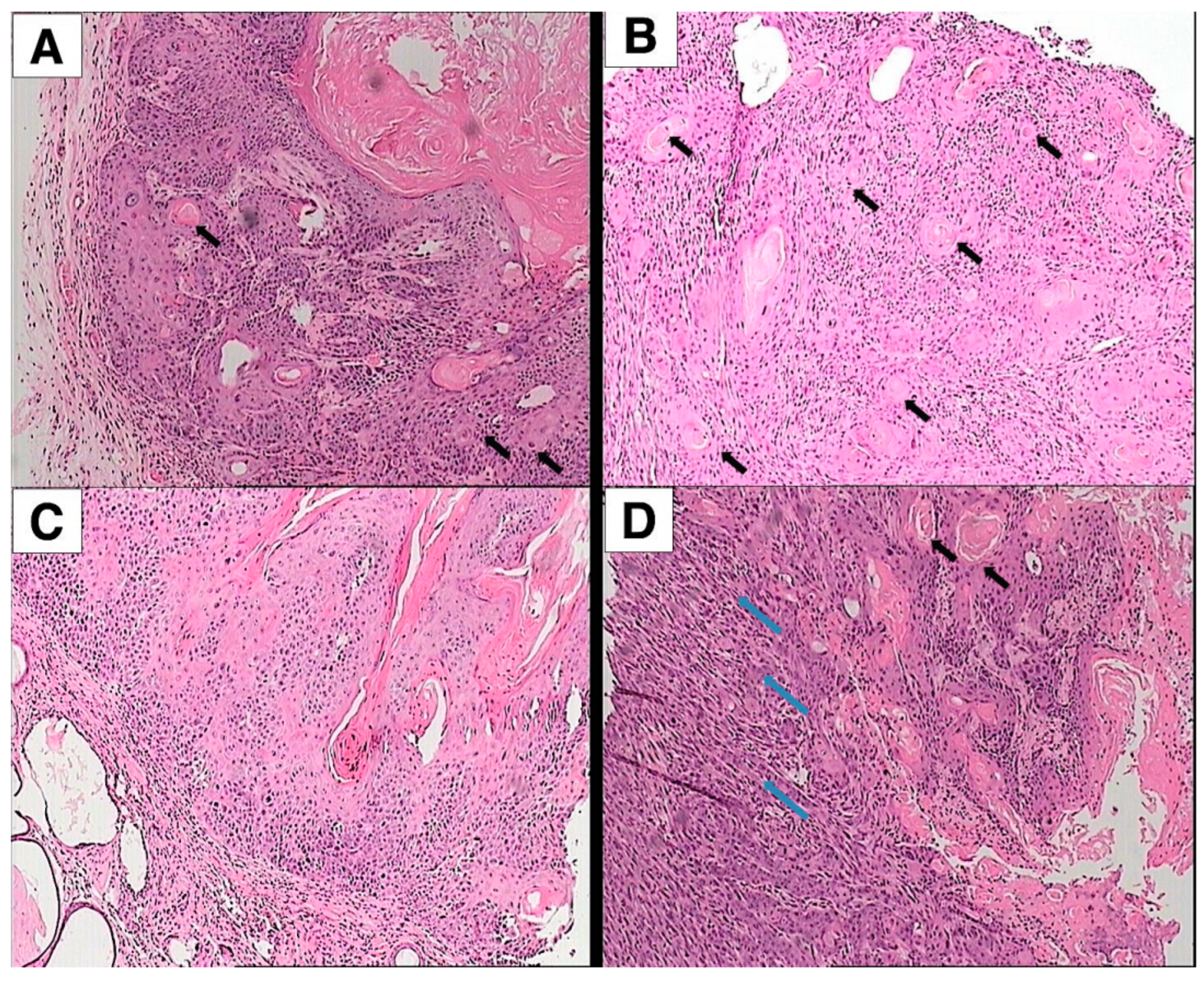 Cancers 16 03546 g003