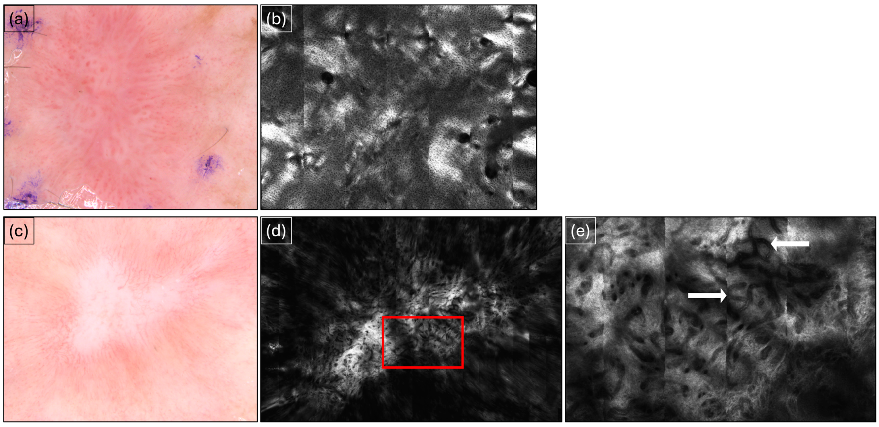 Cancers 16 03557 g002