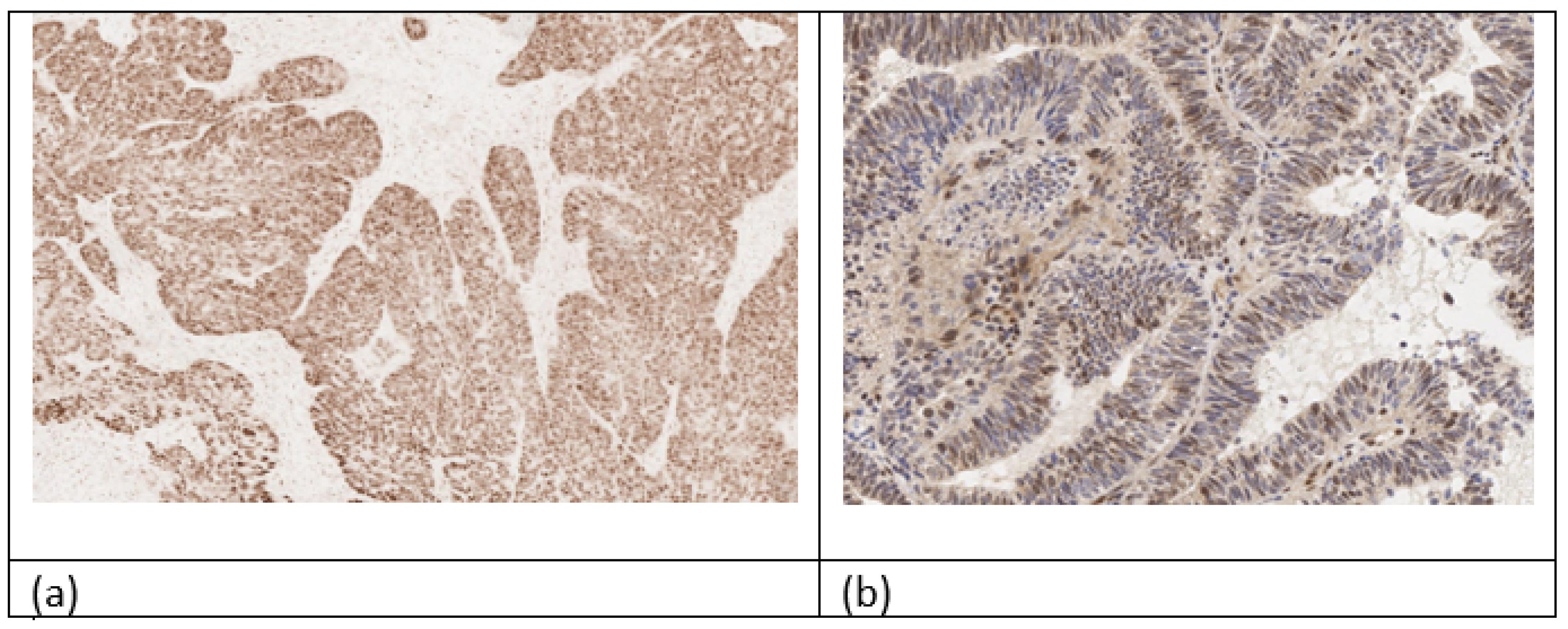 Cancers 16 03560 g003