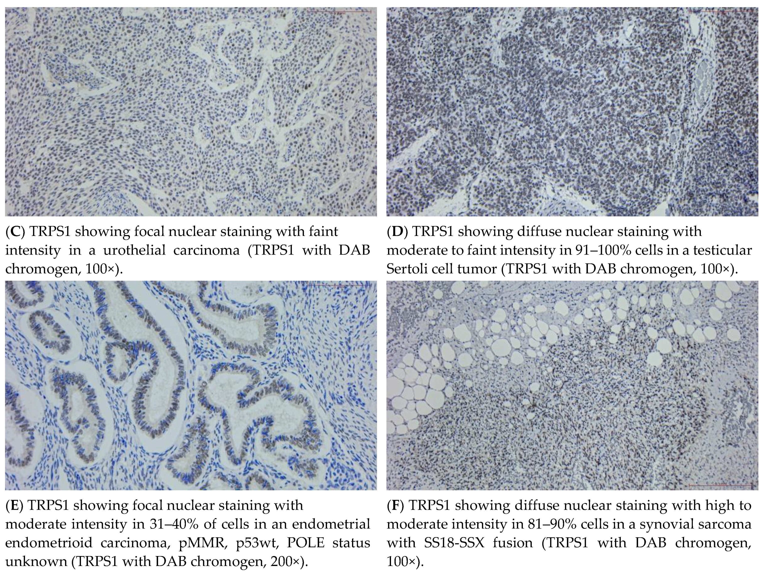 Cancers 16 03568 g002b