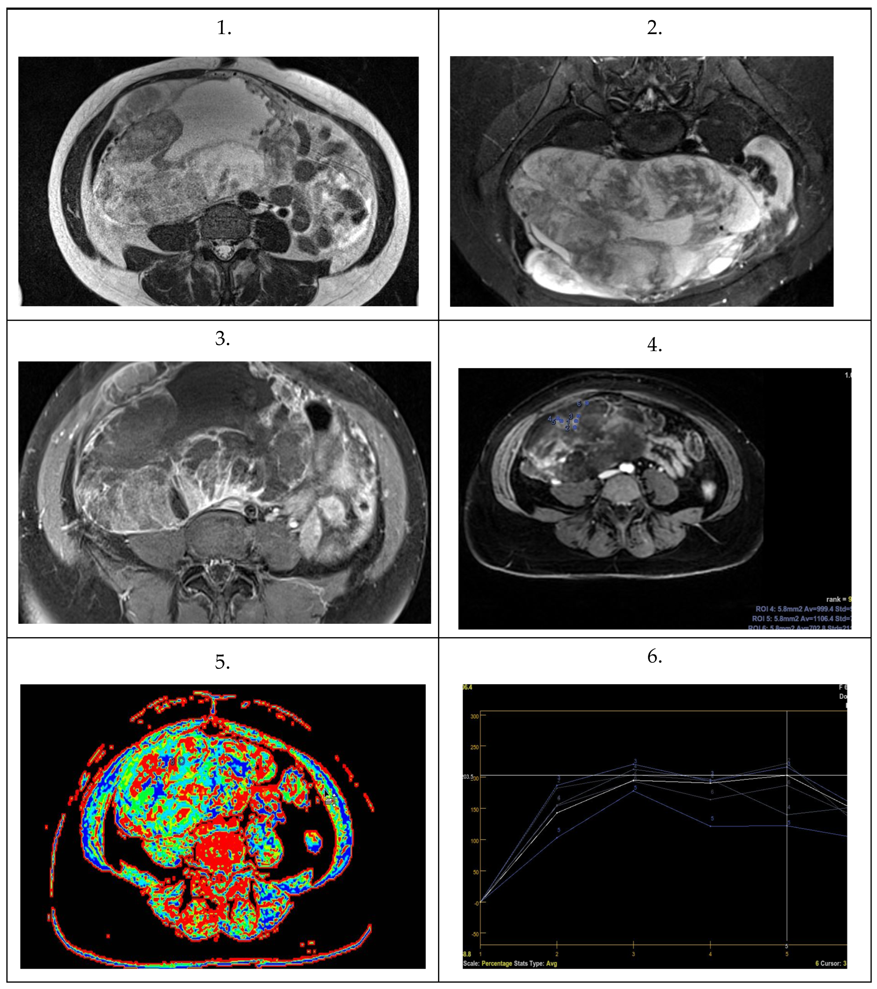 Cancers 16 03569 g018